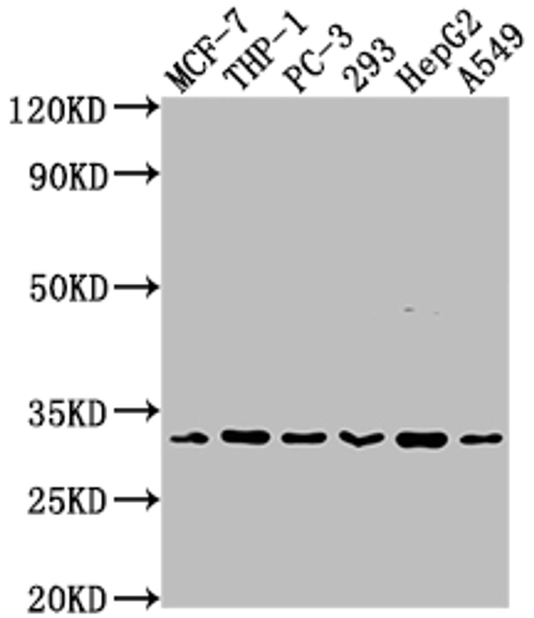 Western Blot. Positive WB detected in: MCF-7 whole cell lysate, THP-1 whole cell lysate, PC-3 whole cell lysate, 293 whole cell lysate, HepG2 whole cell lysate, A549 whole cell lysate. All lanes: CD8A antibody at 1:2000. Secondary. Goat polyclonal to rabbit IgG at 1/50000 dilution. Predicted band size: 26, 22, 31 kDa. Observed band size: 31 kDa.
