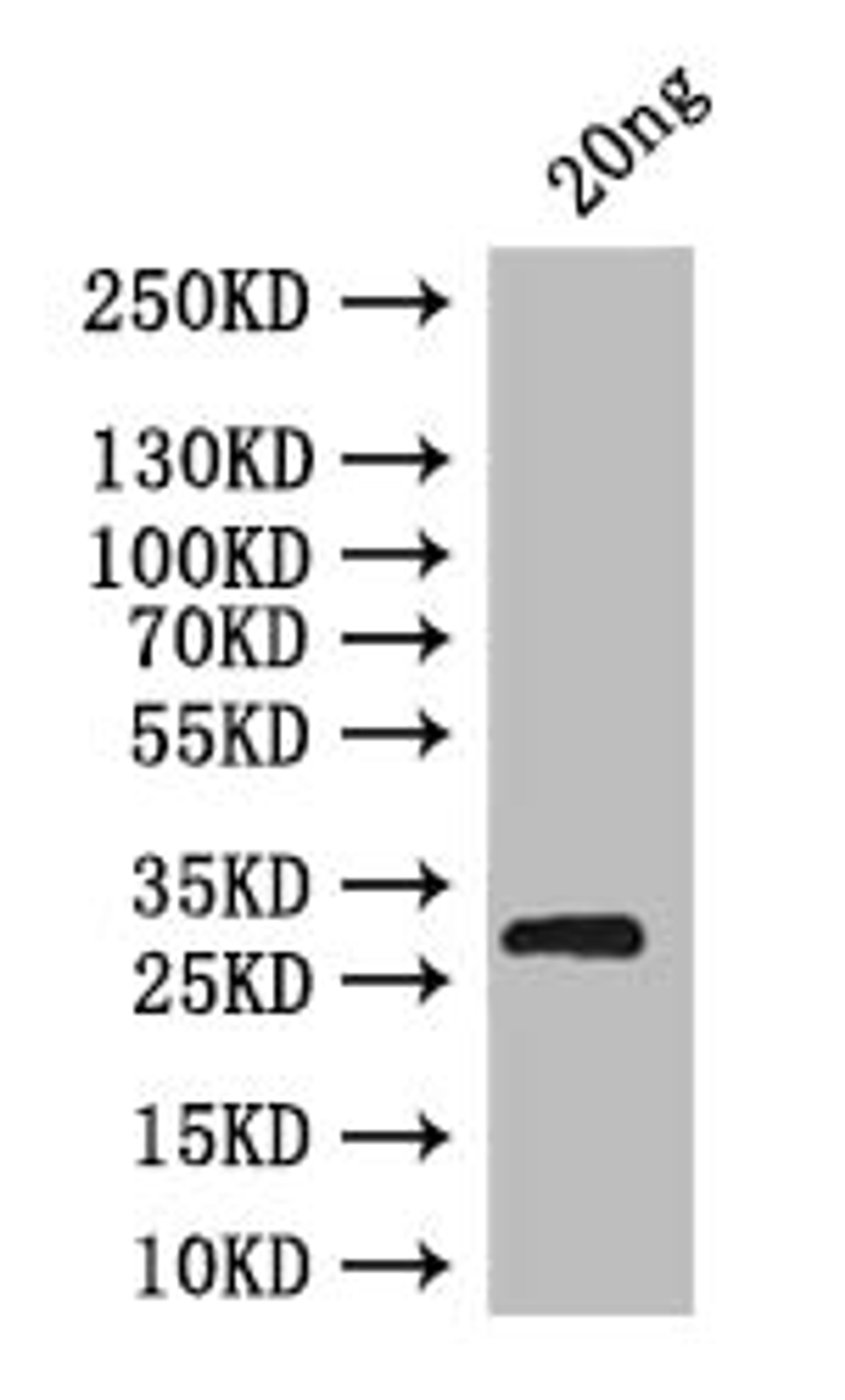 Western Blot. Positive WB detected in: recombinant protein. All lanes: brat Antibody at 1:1000. Secondary. Goat polyclonal to rabbit IgG at 1/50000 dilution. Predicted band size: 31 kDa. Observed band size: 31 kDa. 