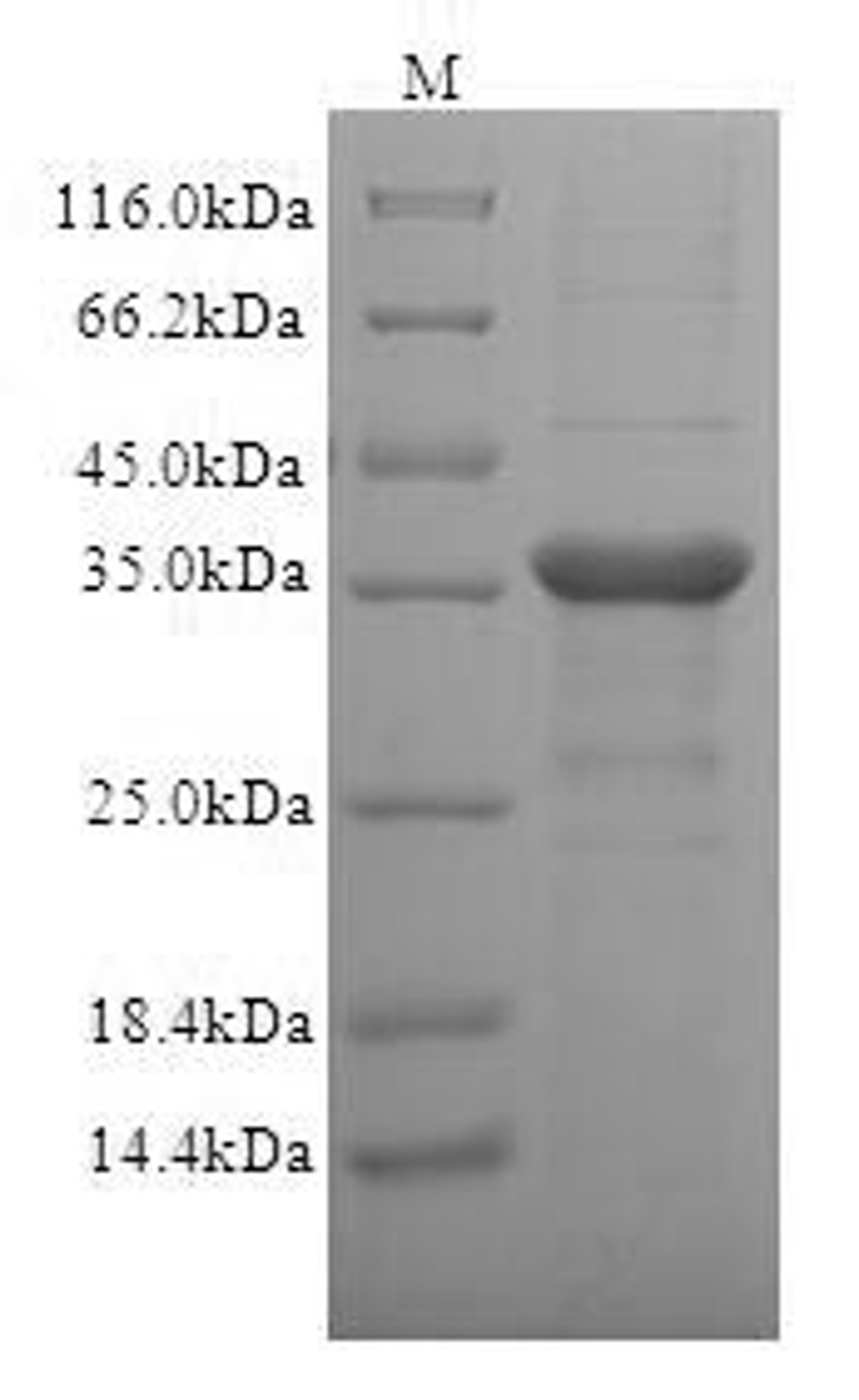 (Tris-Glycine gel) Discontinuous SDS-PAGE (reduced) with 5% enrichment gel and 15% separation gel.