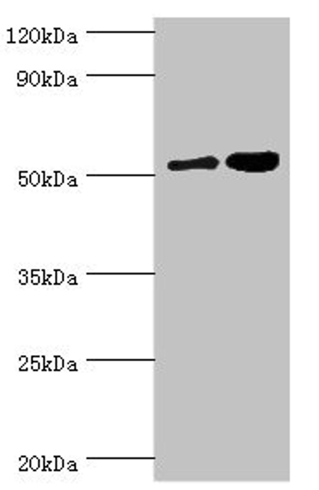 Western blot. All lanes: Dipeptidyl peptidase 2 antibody at 6ug/ml. Lane 1: K562 whole cell lysate. Lane 2: Rat brain tissue. Secondary. Goat polyclonal to rabbit IgG at 1/10000 dilution. Predicted band size: 54 kDa. Observed band size: 54 kDa. 