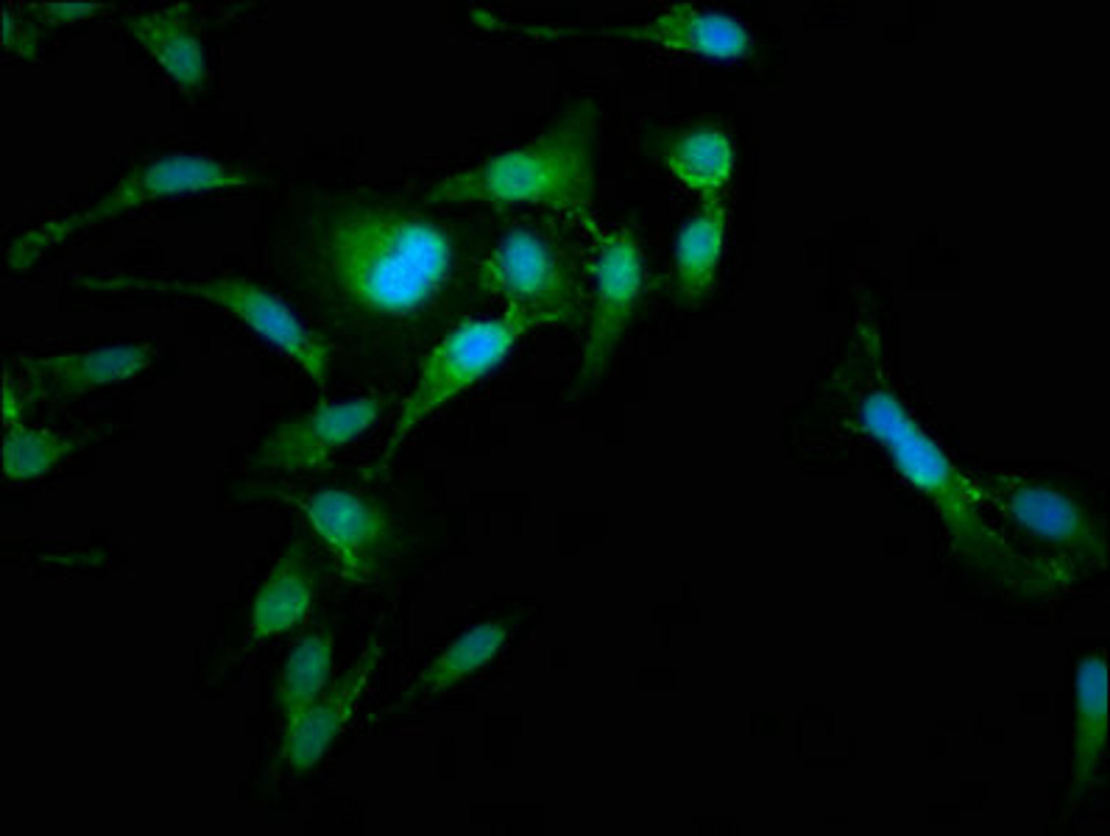 Immunofluorescence staining of Hela cells with CSB-PA614887LA01HU at 1:185, counter-stained with DAPI. The cells were fixed in 4% formaldehyde, permeabilized using 0.2% Triton X-100 and blocked in 10% normal Goat Serum. The cells were then incubated with the antibody overnight at 4&deg;C. The secondary antibody was Alexa Fluor 488-congugated AffiniPure Goat Anti-Rabbit IgG(H+L).