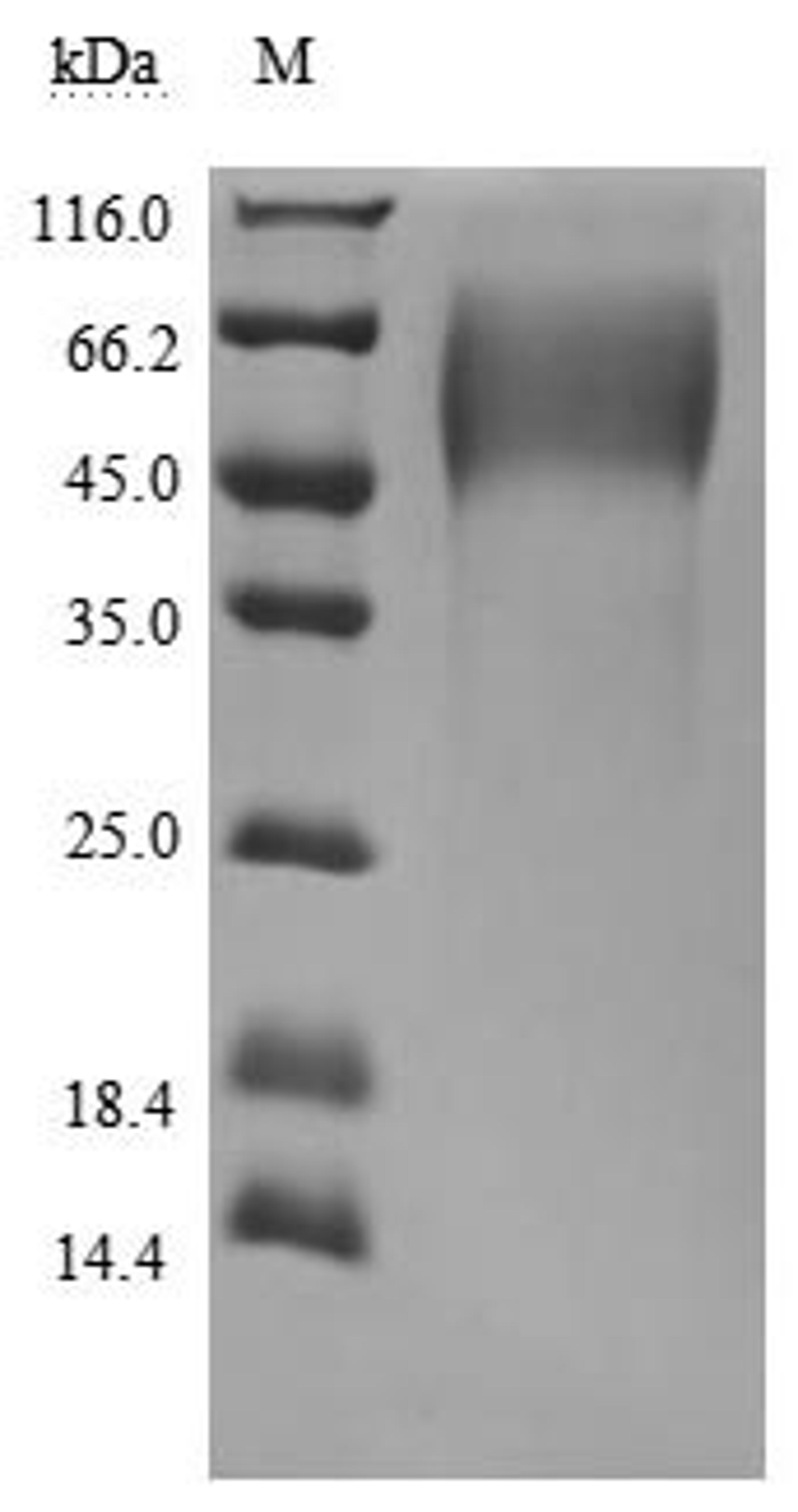 (Tris-Glycine gel) Discontinuous SDS-PAGE (reduced) with 5% enrichment gel and 15% separation gel.