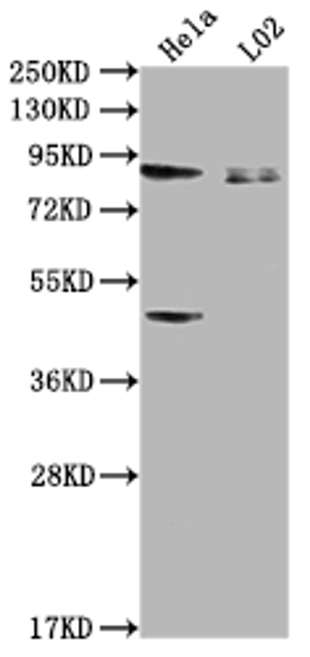 Western Blot. Positive WB detected in: Hela whole cell lysate, L02 whole cell lysate. All lanes: PIBF1 antibody at 1:2000. Secondary. Goat polyclonal to rabbit IgG at 1/50000 dilution. Predicted band size: 90, 26, 13, 36 kDa. Observed band size: 90 kDa. 