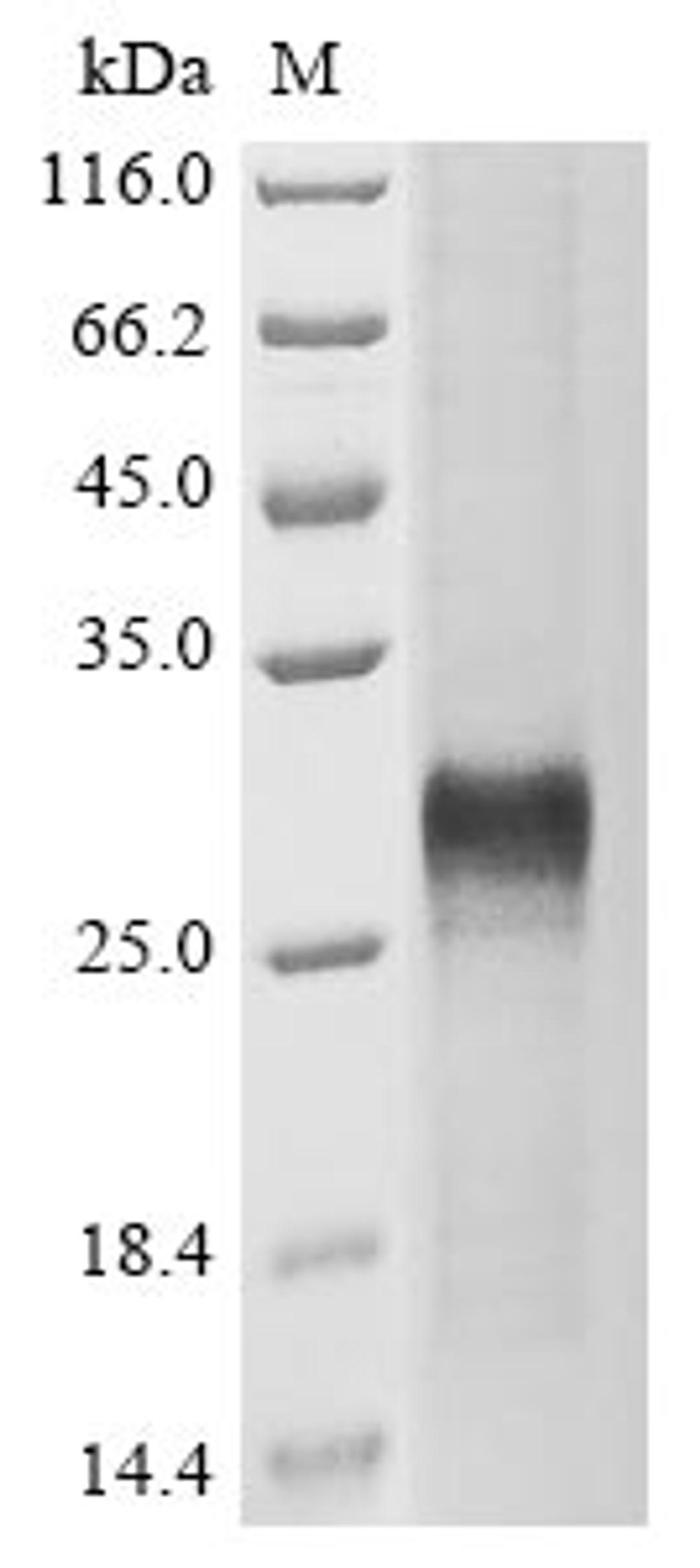 (Tris-Glycine gel) Discontinuous SDS-PAGE (reduced) with 5% enrichment gel and 15% separation gel.