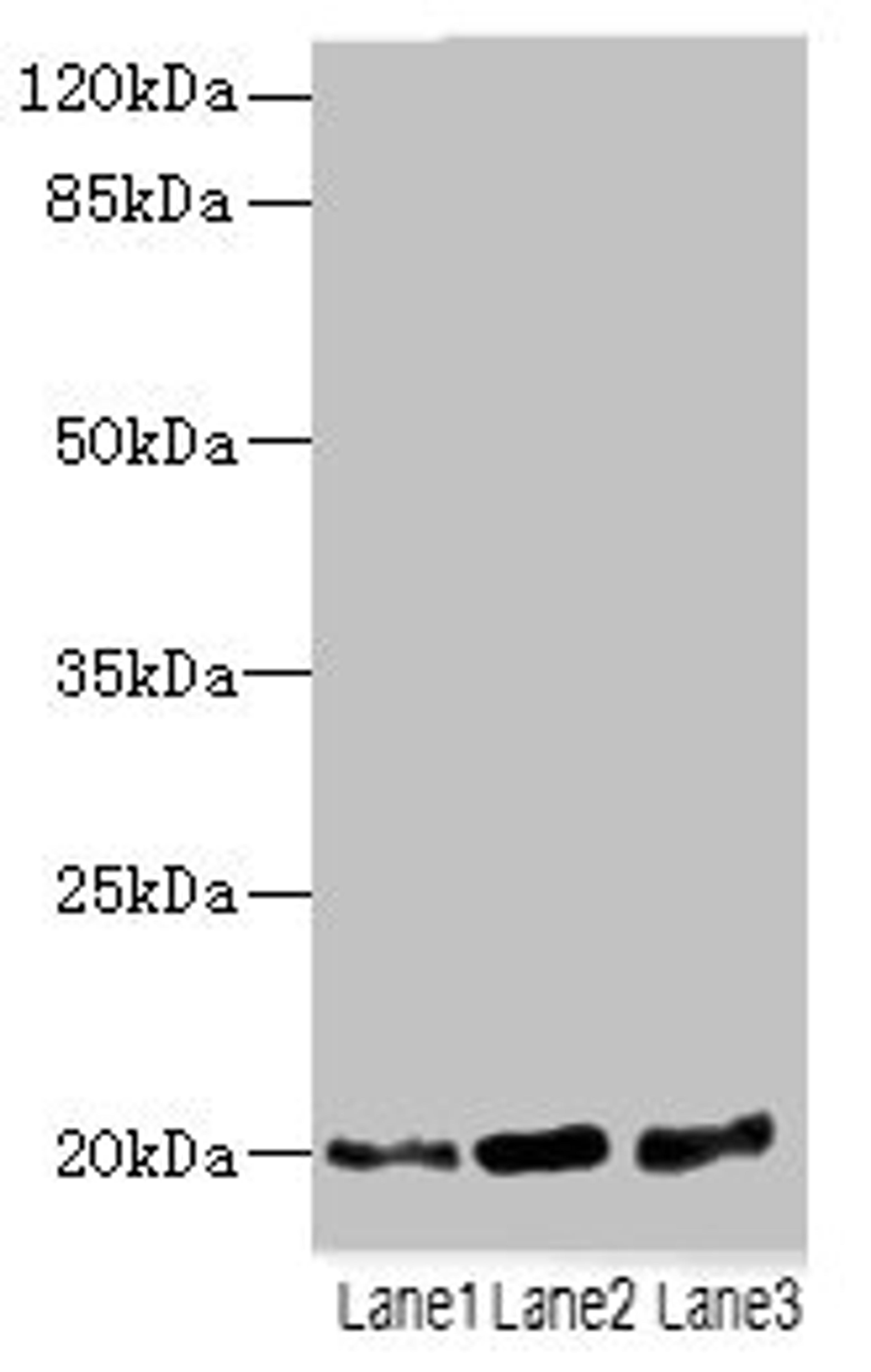 Western blot. All lanes: TPRKB antibody at 5ug/ml. Lane 1: A549 whole cell lysate. Lane 2: Jurkat whole cell lysate. Lane 3: MCF-7 whole cell lysate. Secondary. Goat polyclonal to rabbit IgG at 1/10000 dilution. Predicted band size: 20, 17, 24 kDa. Observed band size: 20 kDa. 