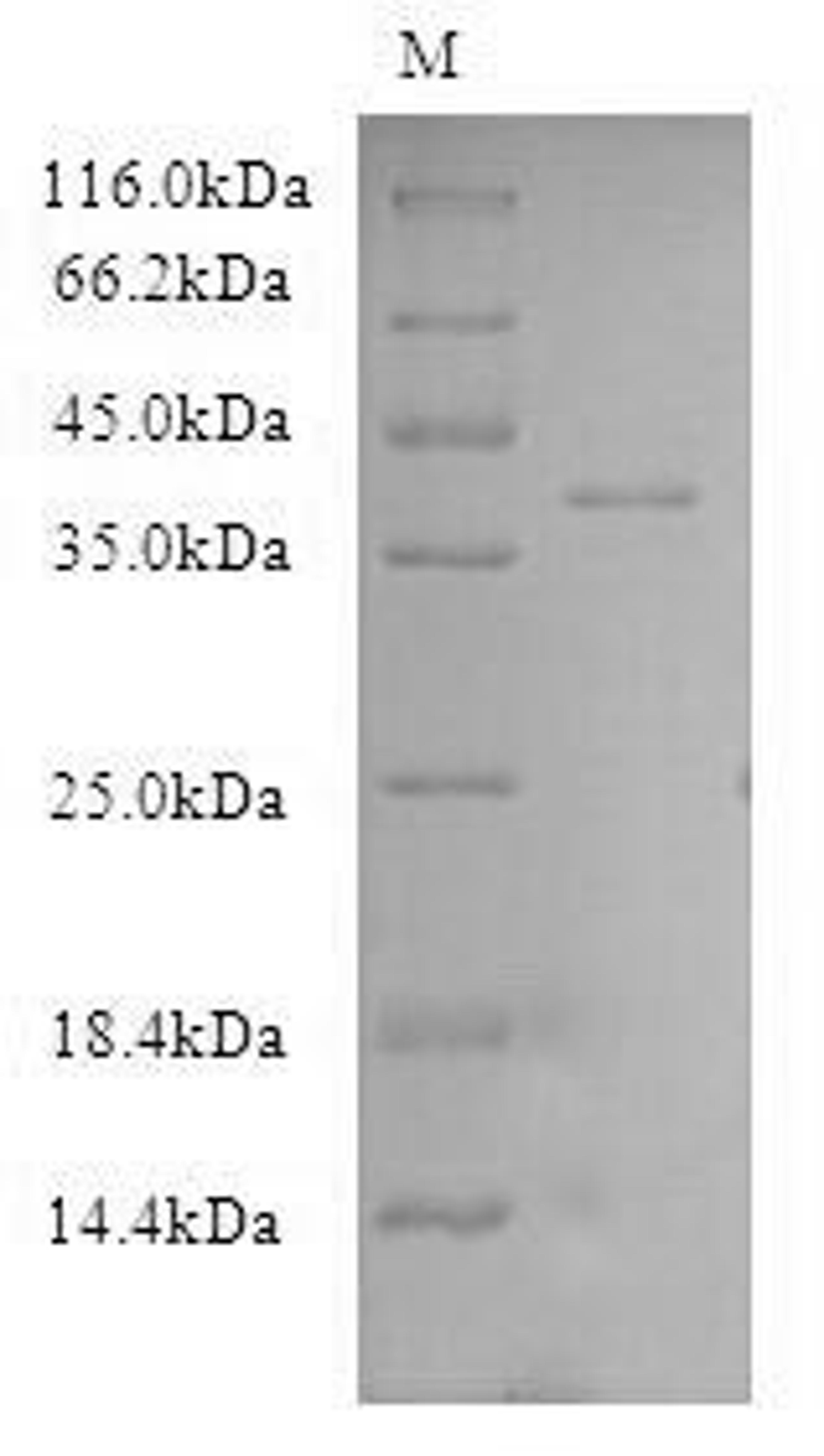 (Tris-Glycine gel) Discontinuous SDS-PAGE (reduced) with 5% enrichment gel and 15% separation gel.
