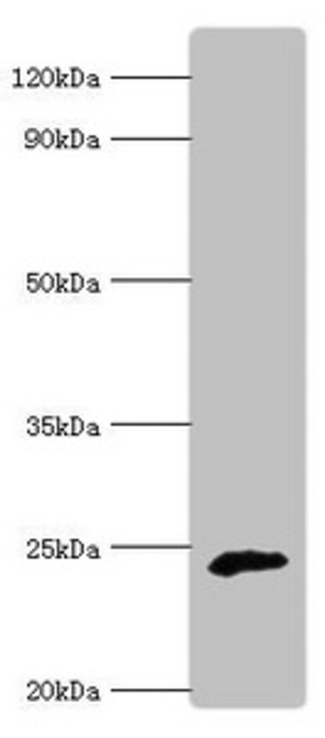 Western blot. All lanes: Ubiquinone biosynthesis protein COQ7 homolog antibody at 6ug/ml + Rat heart tissue. Secondary. Goat polyclonal to rabbit IgG at 1/10000 dilution. Predicted band size: 25, 21 kDa. Observed band size: 25 kDa. 