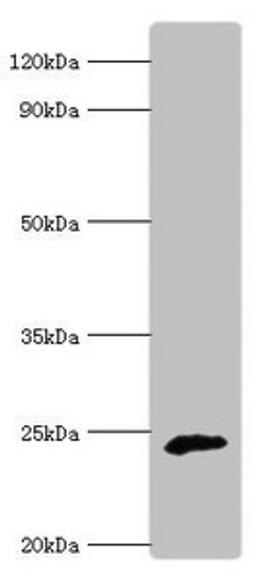 Western blot. All lanes: Ubiquinone biosynthesis protein COQ7 homolog antibody at 6ug/ml + Rat heart tissue. Secondary. Goat polyclonal to rabbit IgG at 1/10000 dilution. Predicted band size: 25, 21 kDa. Observed band size: 25 kDa. 