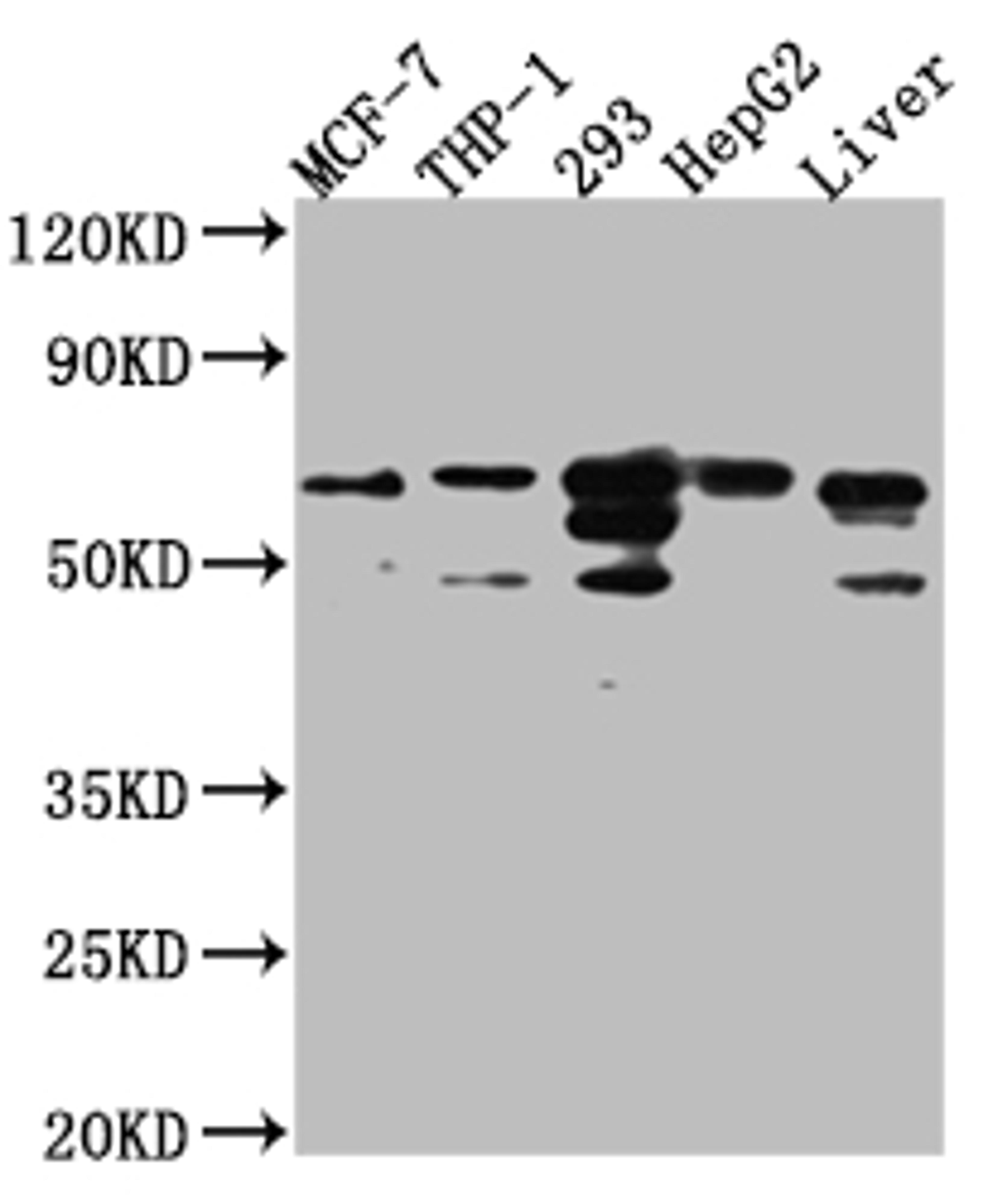 Western Blot. Positive WB detected in: MCF-7 whole cell lysate, THP-1 whole cell lysate, 293 whole cell lysate, HepG2 whole cell lysate, Mouse Liver whole cell lysate. All lanes: FAAH1 Antibody at 1:1000. Secondary. Goat polyclonal to rabbit IgG at 1/50000 dilution. Predicted band size: 64 kDa. Observed band size: 64 kDa. 