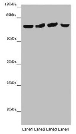 Western blot. All lanes: FRMD5 antibody at 16 ug/ml. Lane 1: Mouse kidney tissue. Lane 2: Mouse heart tissue. Lane 3: Mouse skeletal muscle tissue. Lane 4: Mouse lung tissue. Secondary. Goat polyclonal to rabbit IgG at 1/10000 dilution. Predicted band size: 66, 64 kDa. Observed band size: 65 kDa. 