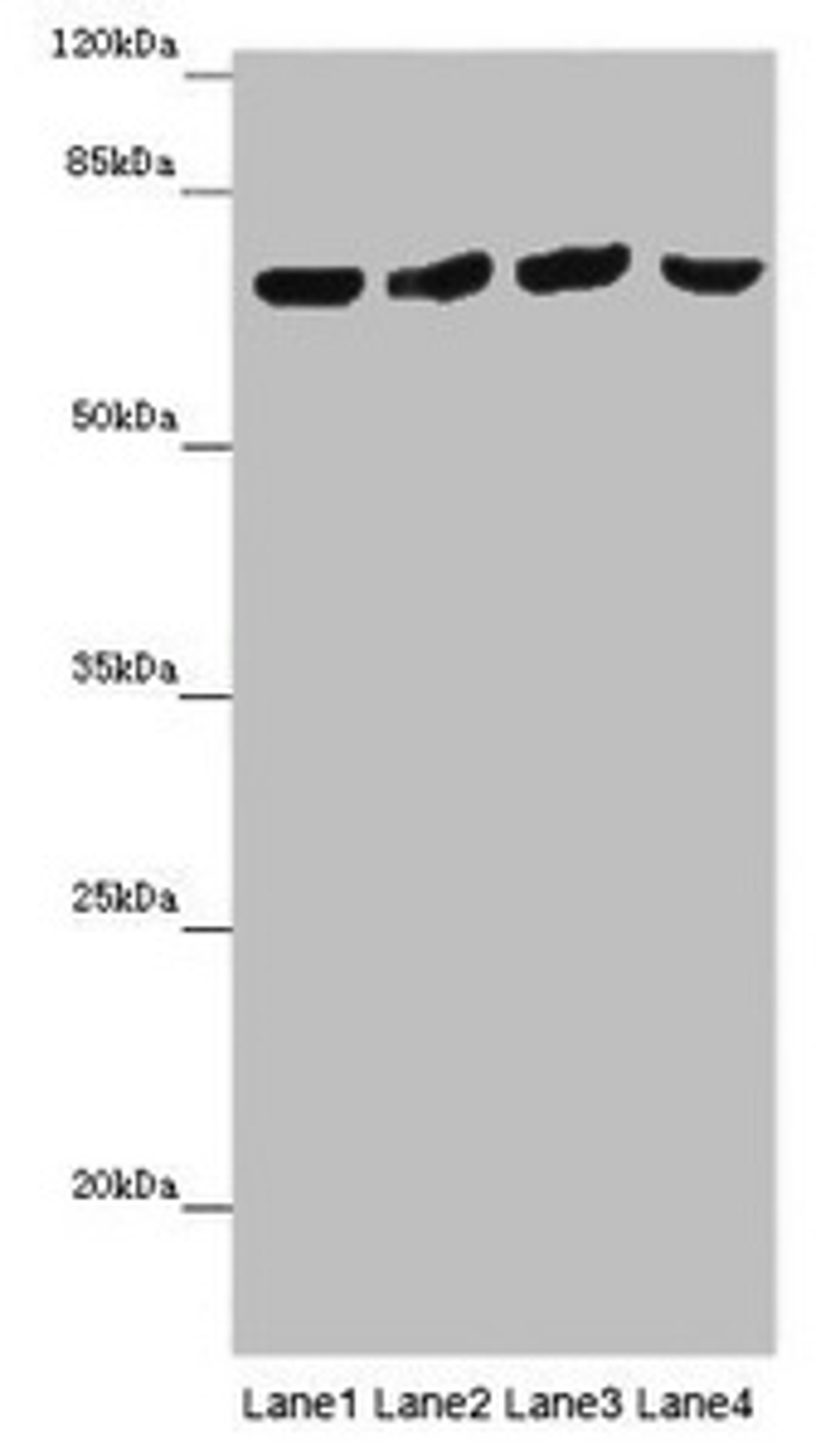 Western blot. All lanes: FRMD5 antibody at 16 ug/ml. Lane 1: Mouse kidney tissue. Lane 2: Mouse heart tissue. Lane 3: Mouse skeletal muscle tissue. Lane 4: Mouse lung tissue. Secondary. Goat polyclonal to rabbit IgG at 1/10000 dilution. Predicted band size: 66, 64 kDa. Observed band size: 65 kDa. 