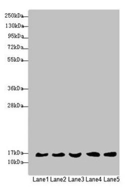 Western blot. All lanes: MRPS16 antibody at 1.35µg/ml. Lane 1: Mouse liver tissue. Lane 2: 293T whole cell lysate. Lane 3: Jurkat whole cell lysate. Lane 4: Raji whole cell lysate. Lane 5: HepG2 whole cell lysate. Secondary. Goat polyclonal to rabbit IgG at 1/10000 dilution. Predicted band size: 16, 14 kDa. Observed band size: 16 kDa