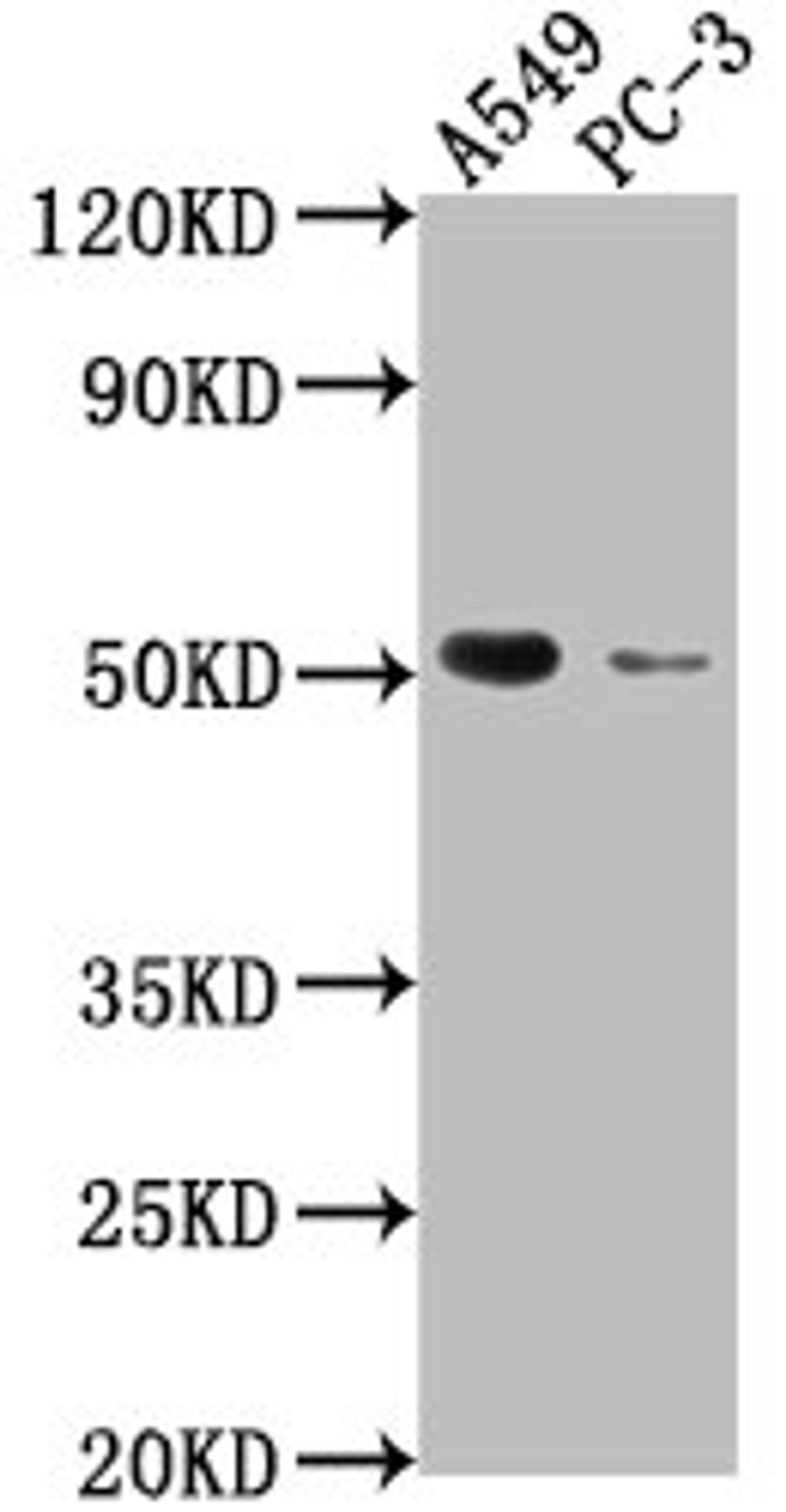 Western Blot. Positive WB detected in: A549 whole cell lysate, PC-3 whole cell lysate. All lanes: TNFRSF1A antibody at 1:2000. Secondary. Goat polyclonal to rabbit IgG at 1/50000 dilution. Predicted band size: 51, 39, 26, 25 kDa. Observed band size: 51 kDa. 