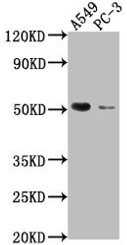 Western Blot. Positive WB detected in: A549 whole cell lysate, PC-3 whole cell lysate. All lanes: TNFRSF1A antibody at 1:2000. Secondary. Goat polyclonal to rabbit IgG at 1/50000 dilution. Predicted band size: 51, 39, 26, 25 kDa. Observed band size: 51 kDa. 