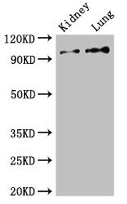 Western Blot. Positive WB detected in: Mouse kidney tissue, Rat lung tissue. All lanes: VAV3 antibody at 2.5ug/ml. Secondary. Goat polyclonal to rabbit IgG at 1/50000 dilution. Predicted band size: 98, 87, 33, 101 kDa. Observed band size: 98 kDa. 