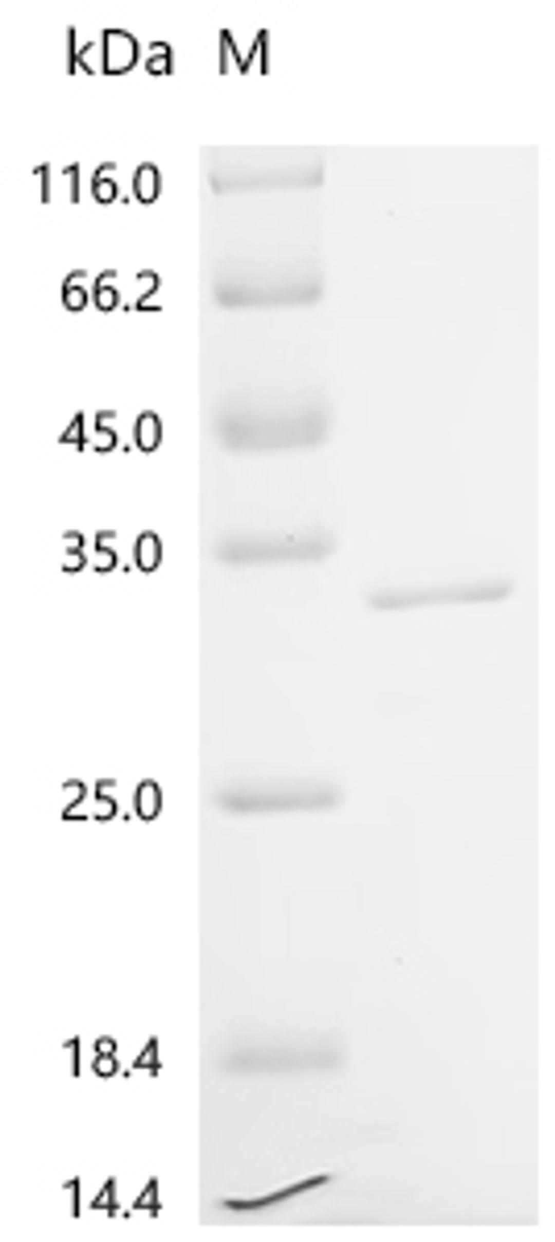(Tris-Glycine gel) Discontinuous SDS-PAGE (reduced) with 5% enrichment gel and 15% separation gel.