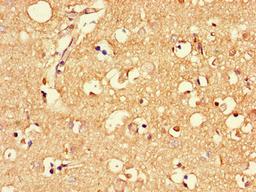 Immunohistochemistry of paraffin-embedded human brain tissue using CSB-PA613581LA01HU at dilution of 1:100