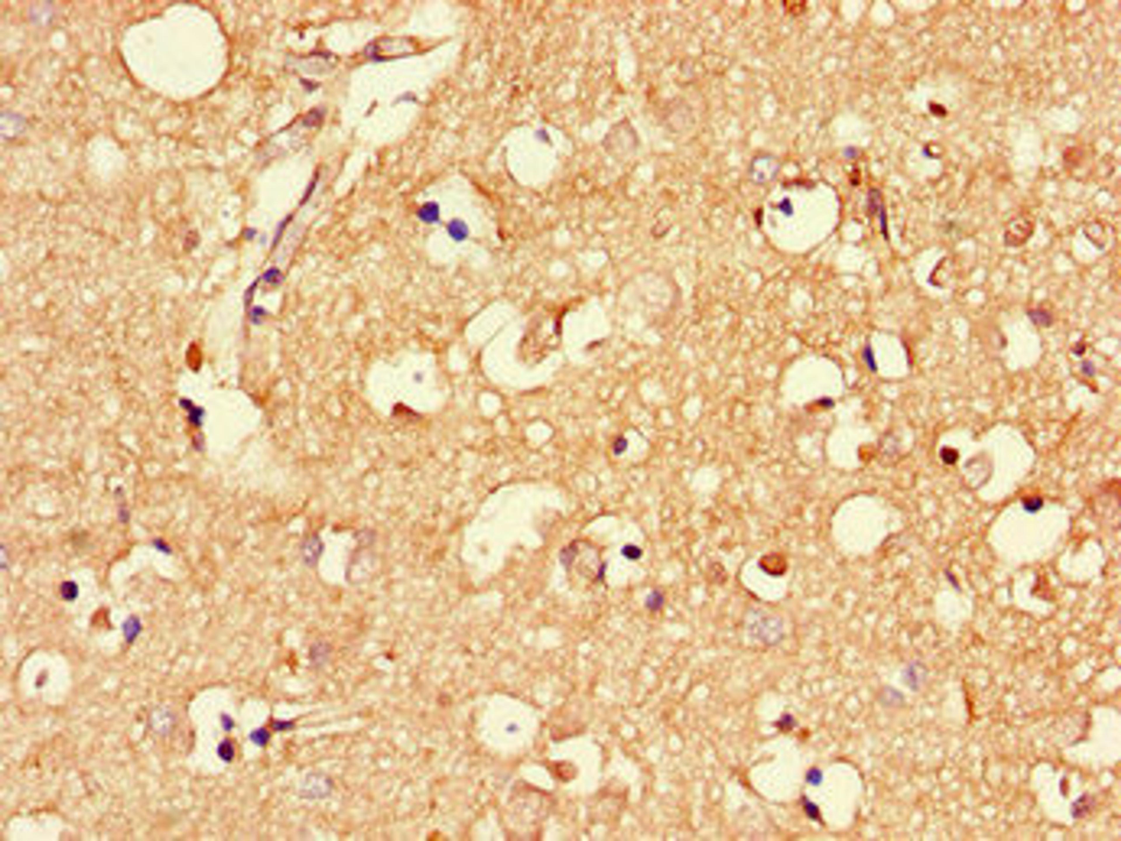 Immunohistochemistry of paraffin-embedded human brain tissue using CSB-PA613581LA01HU at dilution of 1:100