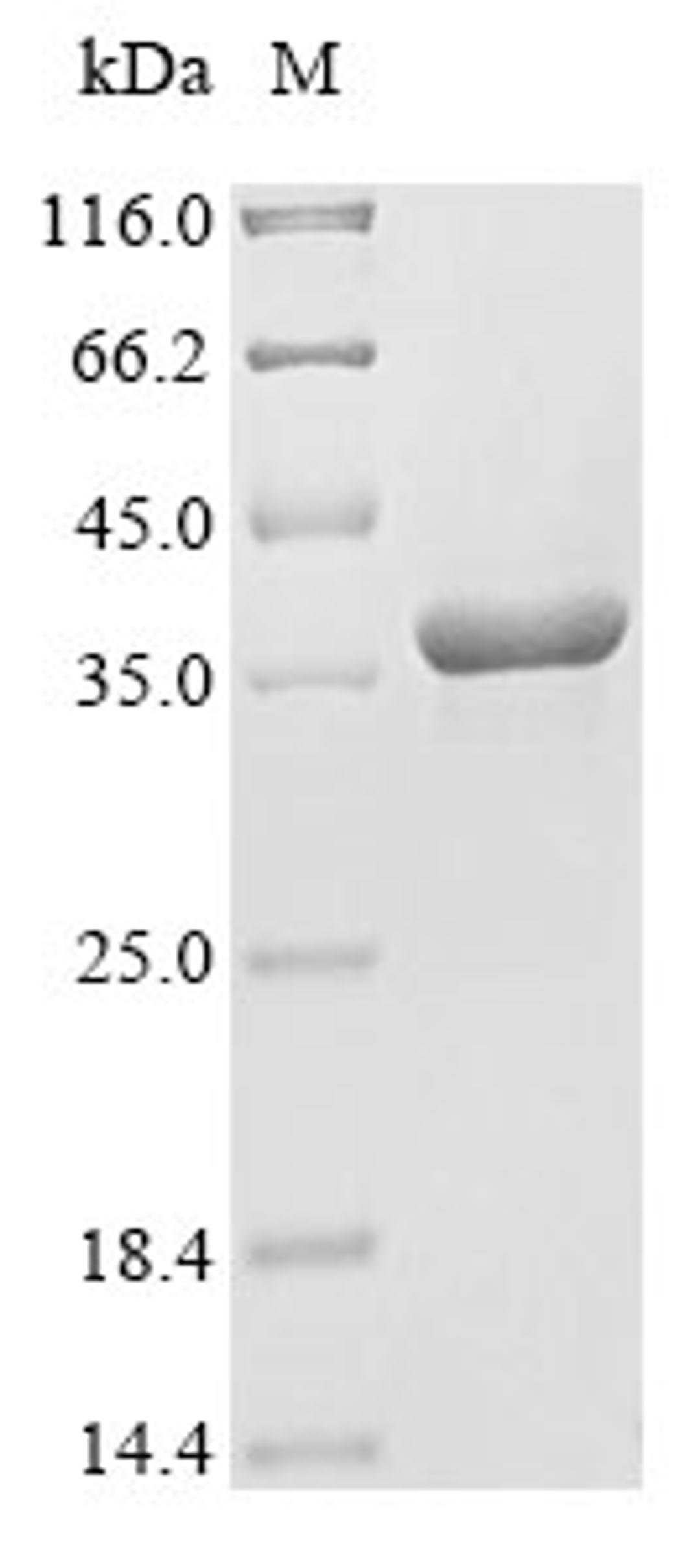 (Tris-Glycine gel) Discontinuous SDS-PAGE (reduced) with 5% enrichment gel and 15% separation gel.
