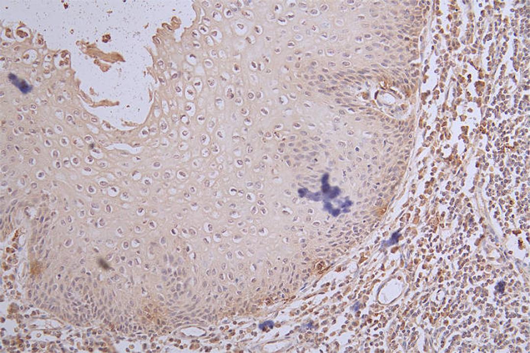 IHC image of CSB-RA984483A0HU diluted at 1:100 and staining in paraffin-embedded human tonsil tissue performed on a Leica BondTM system. After dewaxing and hydration, antigen retrieval was mediated by high pressure in a citrate buffer (pH 6.0). Section was blocked with 10% normal goat serum 30min at RT. Then primary antibody (1% BSA) was incubated at 4°C overnight. The primary is detected by a Goat anti-rabbit polymer IgG labeled by HRP and visualized using 0.65% DAB.