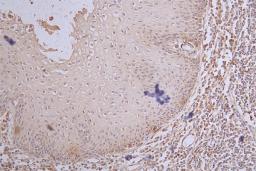 IHC image of CSB-RA984483A0HU diluted at 1:100 and staining in paraffin-embedded human tonsil tissue performed on a Leica BondTM system. After dewaxing and hydration, antigen retrieval was mediated by high pressure in a citrate buffer (pH 6.0). Section was blocked with 10% normal goat serum 30min at RT. Then primary antibody (1% BSA) was incubated at 4°C overnight. The primary is detected by a Goat anti-rabbit polymer IgG labeled by HRP and visualized using 0.65% DAB.