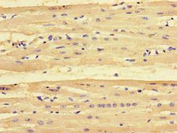 Immunohistochemistry of paraffin-embedded human heart tissue using CSB-PA018229LA01HU at dilution of 1:100