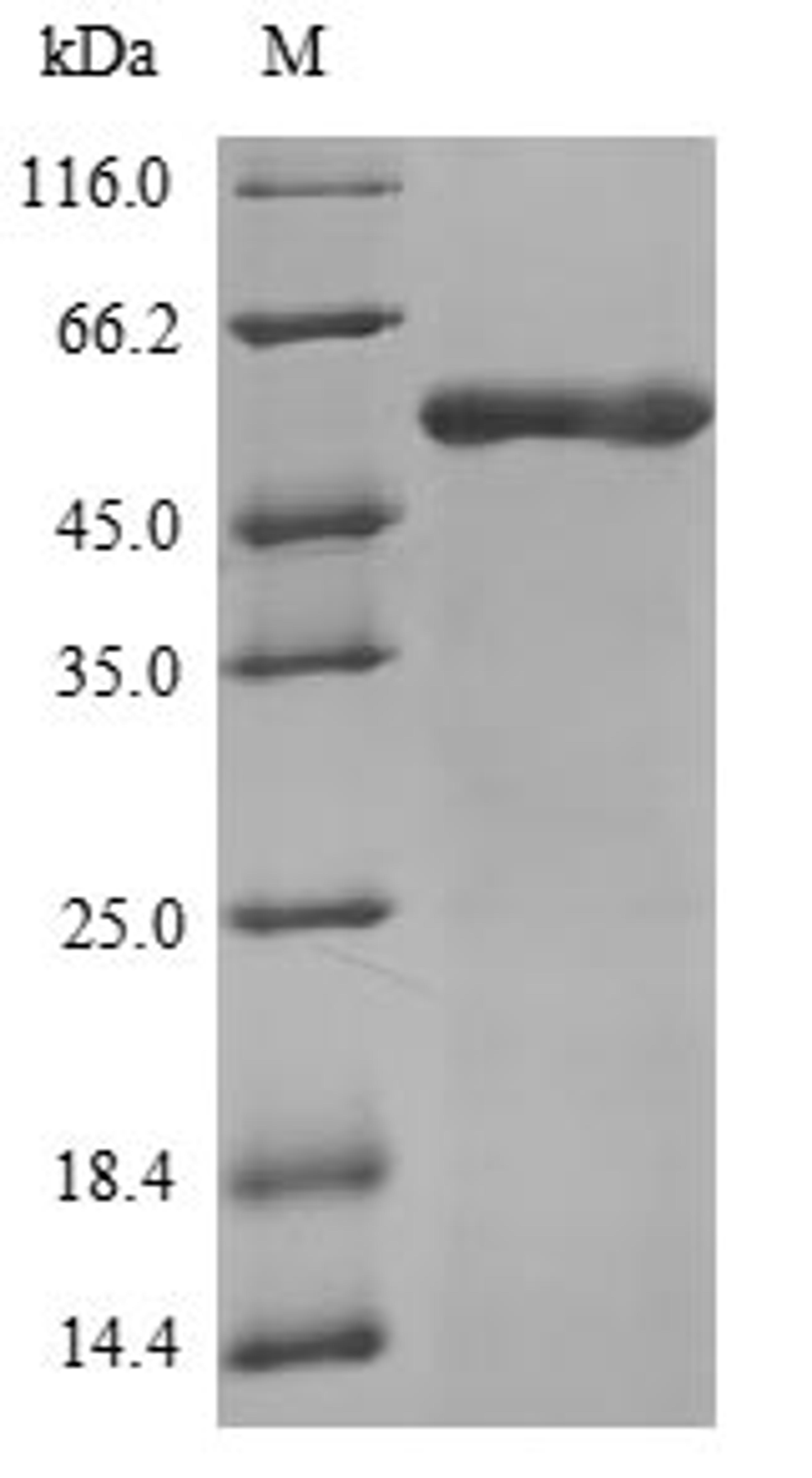 (Tris-Glycine gel) Discontinuous SDS-PAGE (reduced) with 5% enrichment gel and 15% separation gel.