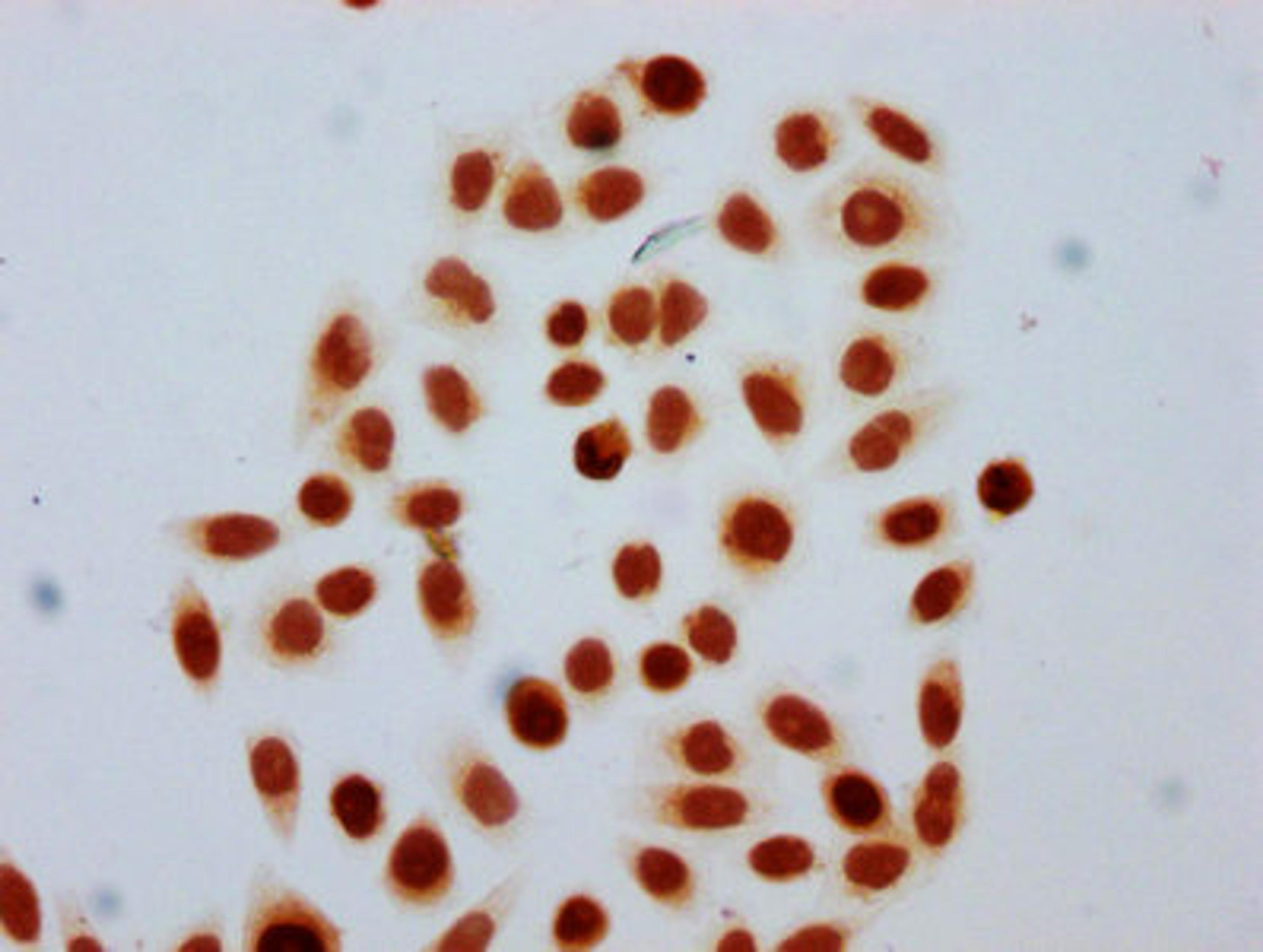 Immunocytochemistry analysis of CSB-PA010429OA91forHU diluted at 1:30 and staining in Hela cells (treated with 30mM sodium butyrate for 4h) performed on a Leica BondTM system. The cells were fixed in 4% formaldehyde, permeabilized using 0.2% Triton X-100 and blocked with 10% normal goat serum 30min at RT. Then primary antibody (1% BSA) was incubated at 4°C overnight. The primary is detected by a biotinylated secondary antibody and visualized using an HRP conjugated SP system.
