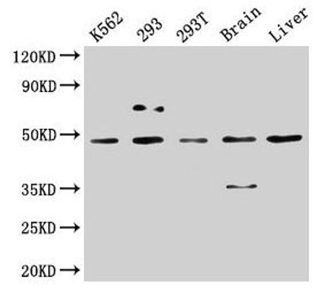 Western Blot. Positive WB detected in: K562 whole cell lysate, 293 whole cell lysate, 293T whole cell lysate, Rat brain tissue, Mouse liver tissue. All lanes: CSNK1D antibody at 5µg/ml. Secondary. Goat polyclonal to rabbit IgG at 1/50000 dilution. Predicted band size: 48, 47 kDa. Observed band size: 48 kDa