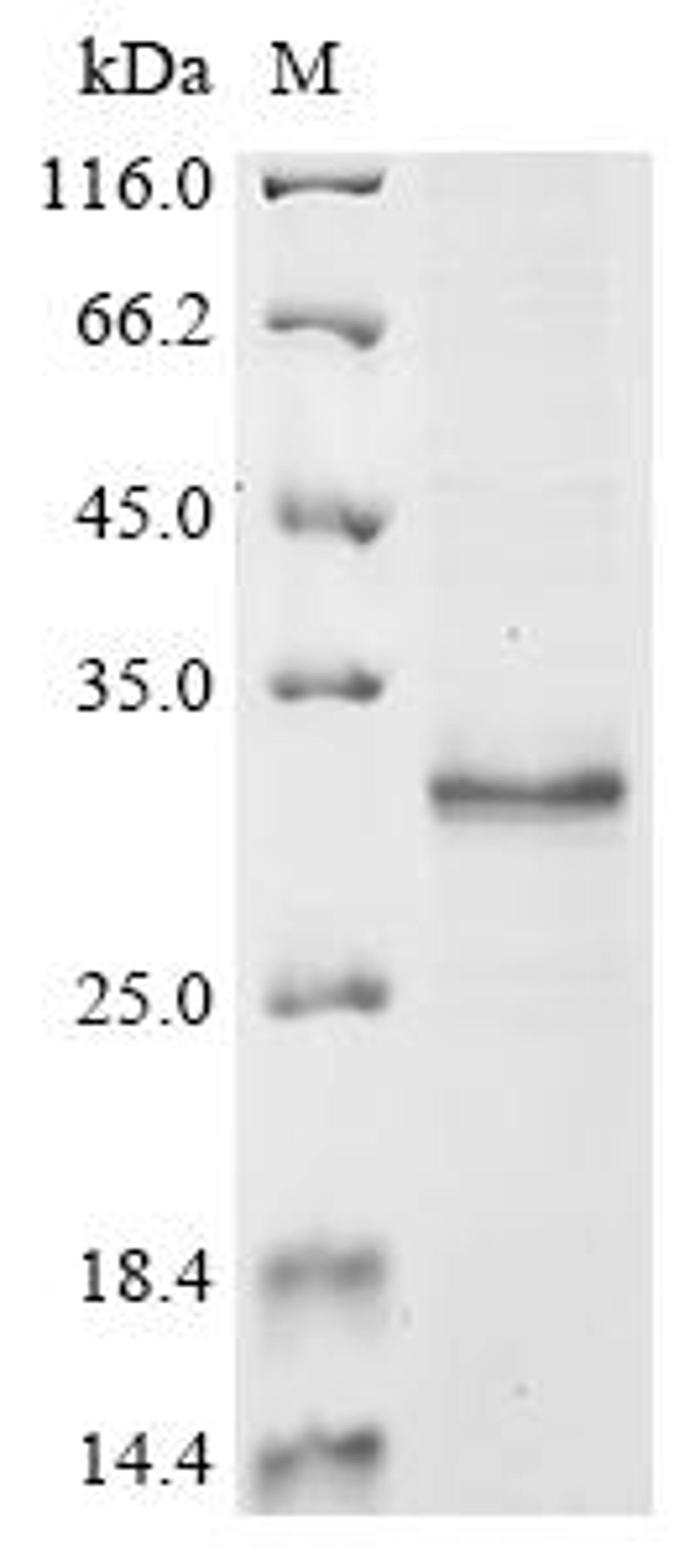 (Tris-Glycine gel) Discontinuous SDS-PAGE (reduced) with 5% enrichment gel and 15% separation gel.