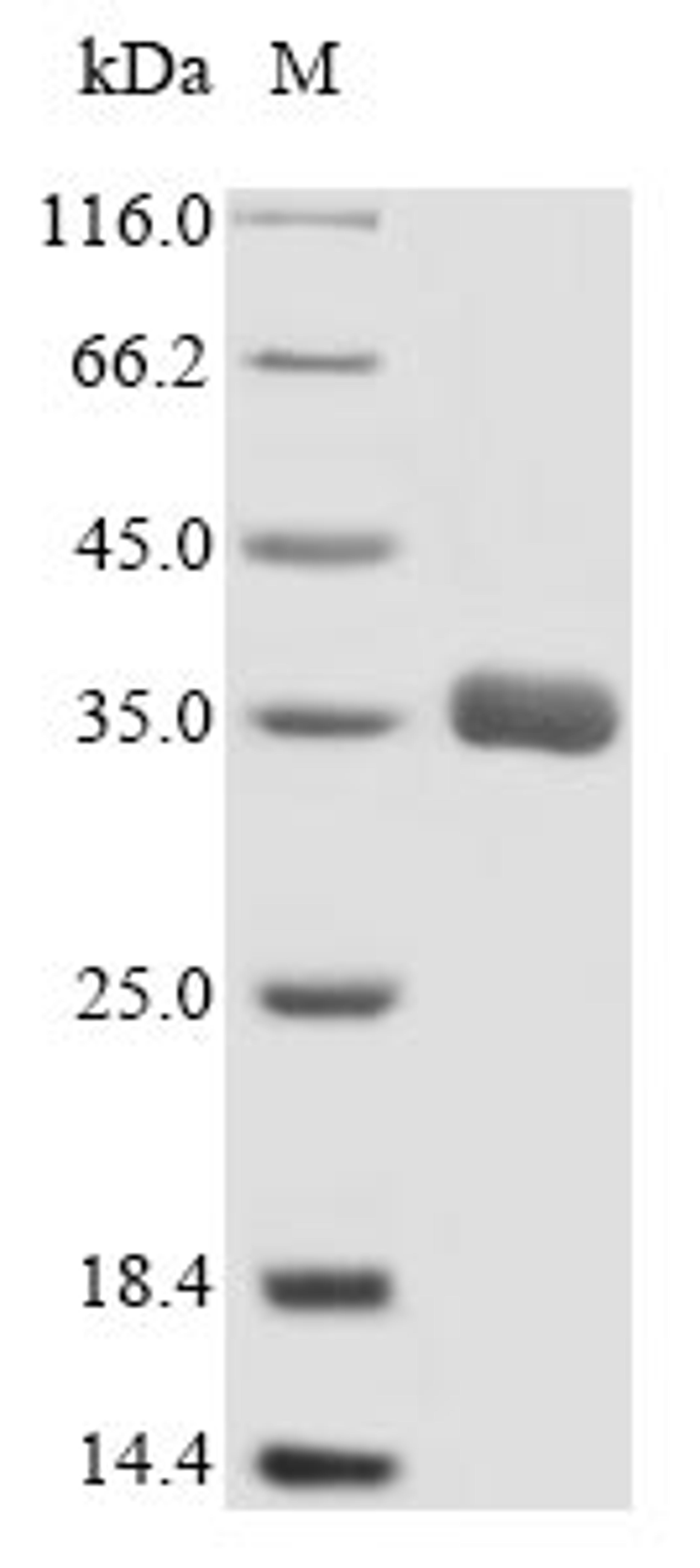 (Tris-Glycine gel) Discontinuous SDS-PAGE (reduced) with 5% enrichment gel and 15% separation gel.