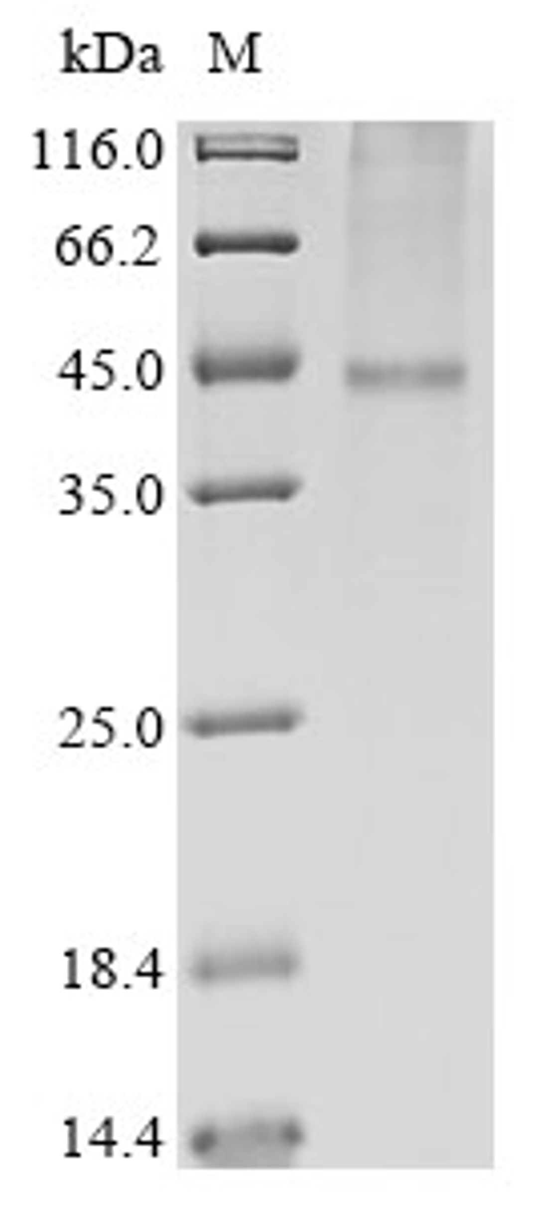 (Tris-Glycine gel) Discontinuous SDS-PAGE (reduced) with 5% enrichment gel and 15% separation gel.