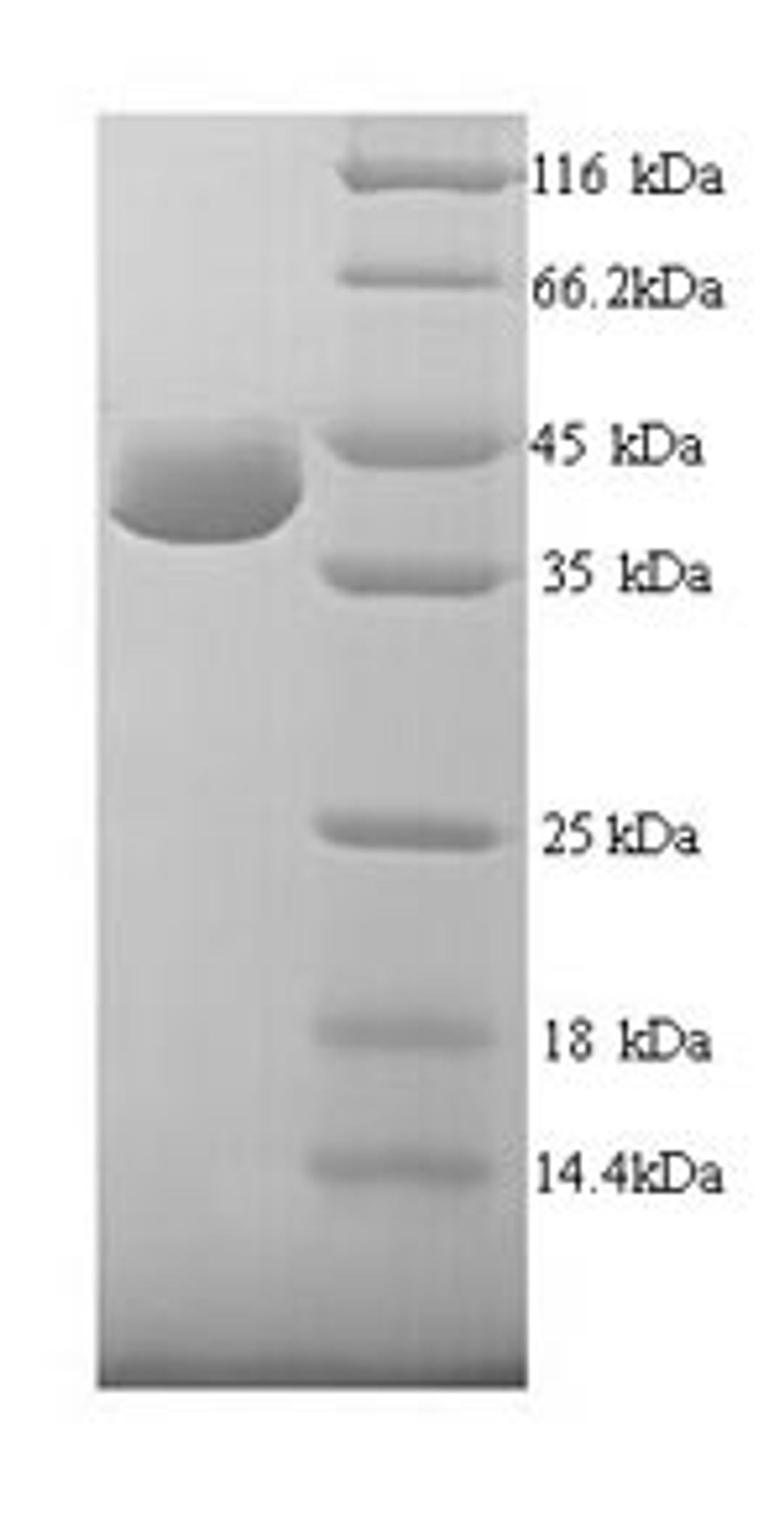 (Tris-Glycine gel) Discontinuous SDS-PAGE (reduced) with 5% enrichment gel and 15% separation gel.