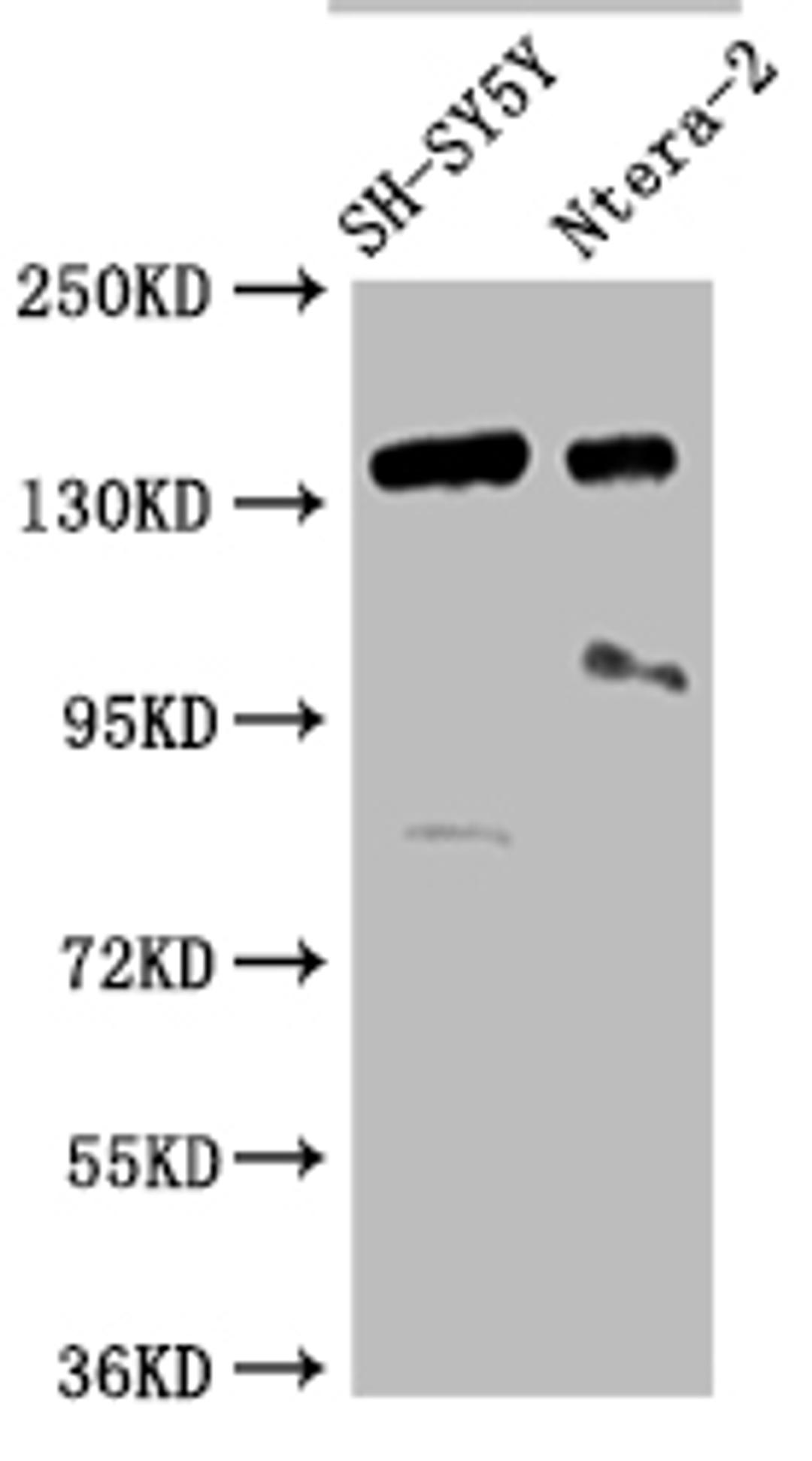 Western Blot.  Positive WB detected in: SH-SY5Y whole cell lysate, Ntera-2 whole cell lysate.  All lanes: ROBO2 antibody at 1:2000.  Secondary.  Goat polyclonal to rabbit IgG at 1/50000 dilution.  Predicted band size: 131, 152, 154 kDa.  Observed band size: 152 kDa. 
