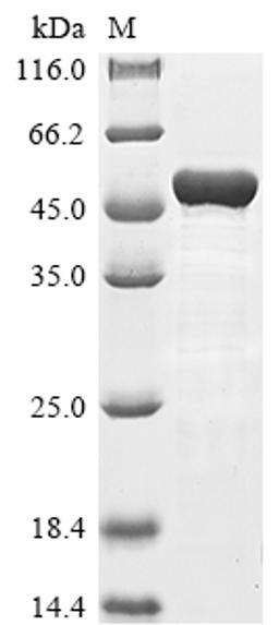 (Tris-Glycine gel) Discontinuous SDS-PAGE (reduced) with 5% enrichment gel and 15% separation gel.