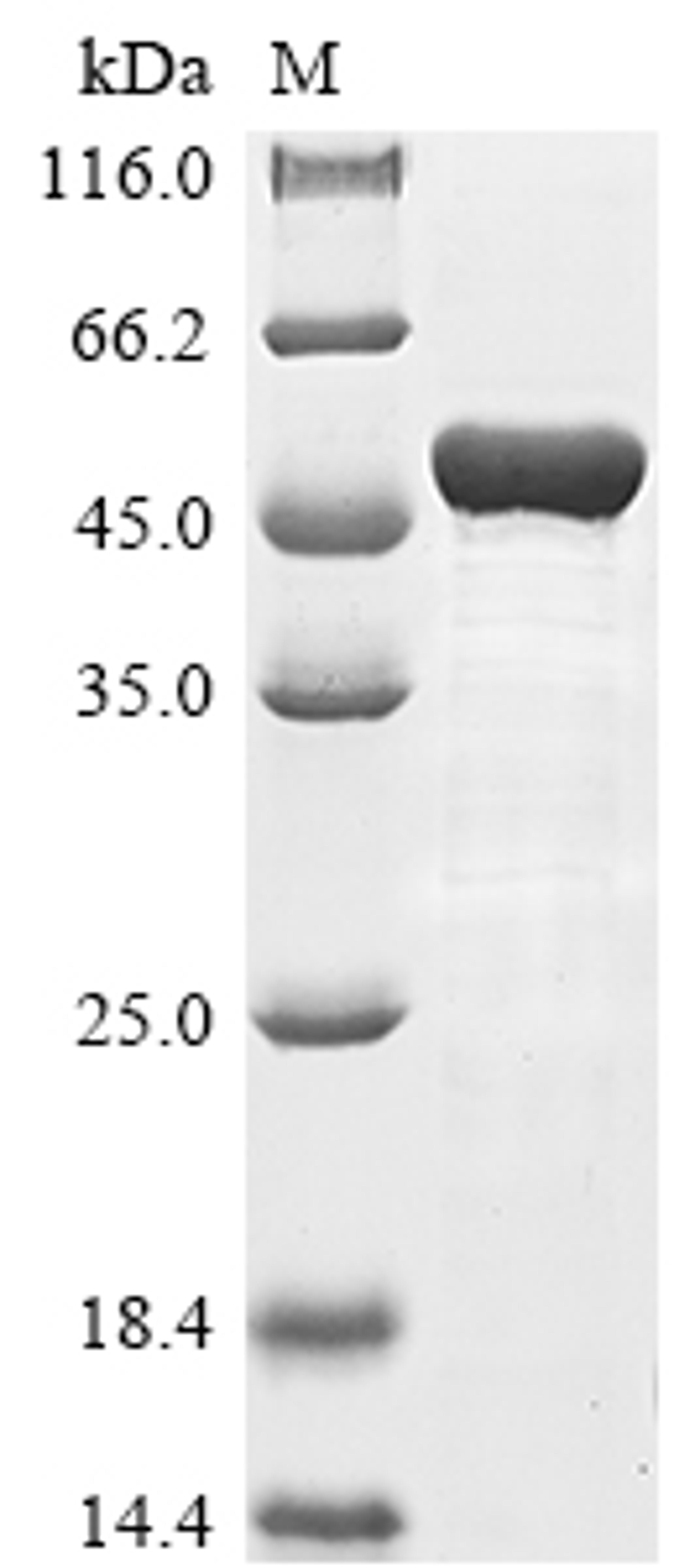 (Tris-Glycine gel) Discontinuous SDS-PAGE (reduced) with 5% enrichment gel and 15% separation gel.