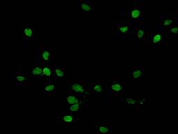 Immunofluorescent analysis of Hela cells (treated with 30mM crotonylate for 4h) using CSB-PA010378PA158crHU at dilution of 1:100 and Alexa Fluor 488-congugated AffiniPure Goat Anti-Rabbit IgG(H+L)