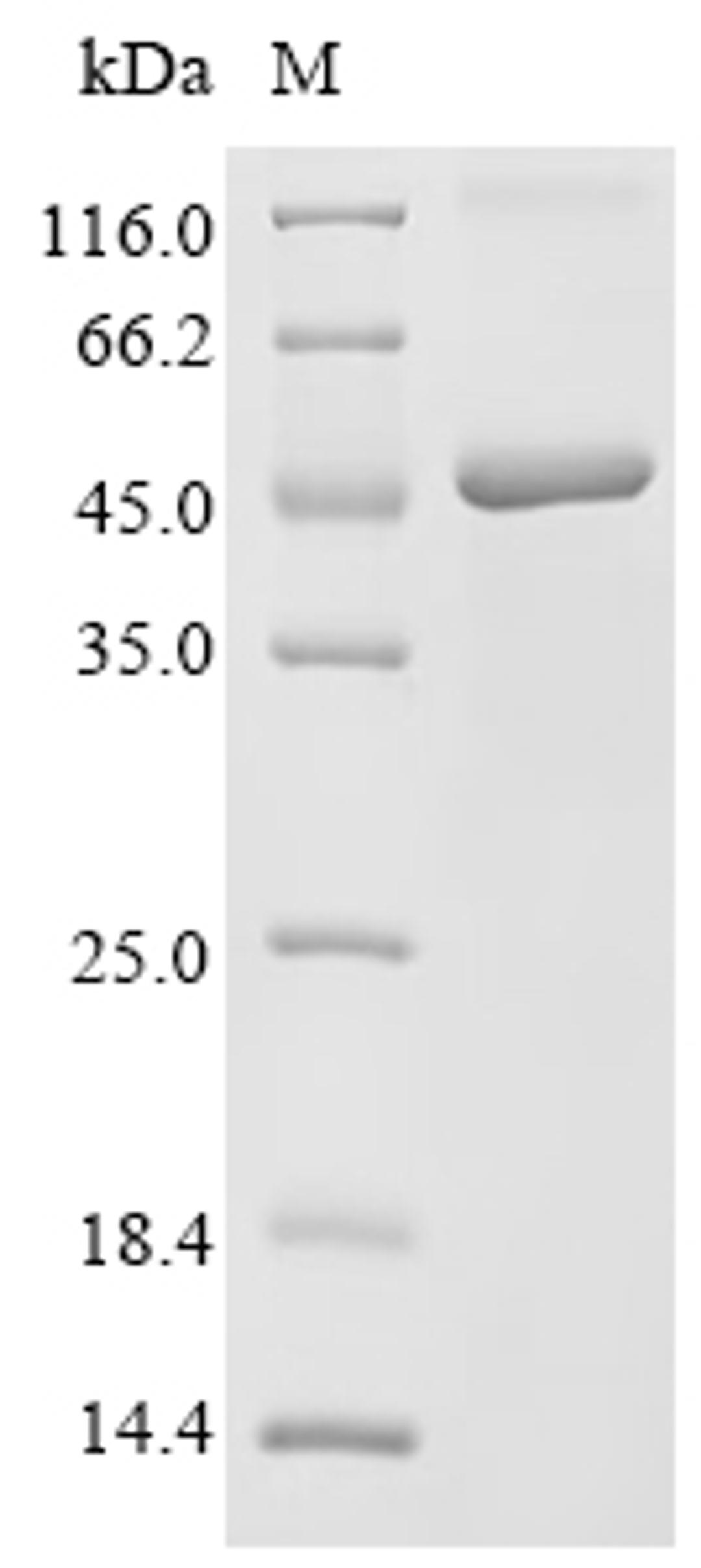 (Tris-Glycine gel) Discontinuous SDS-PAGE (reduced) with 5% enrichment gel and 15% separation gel.