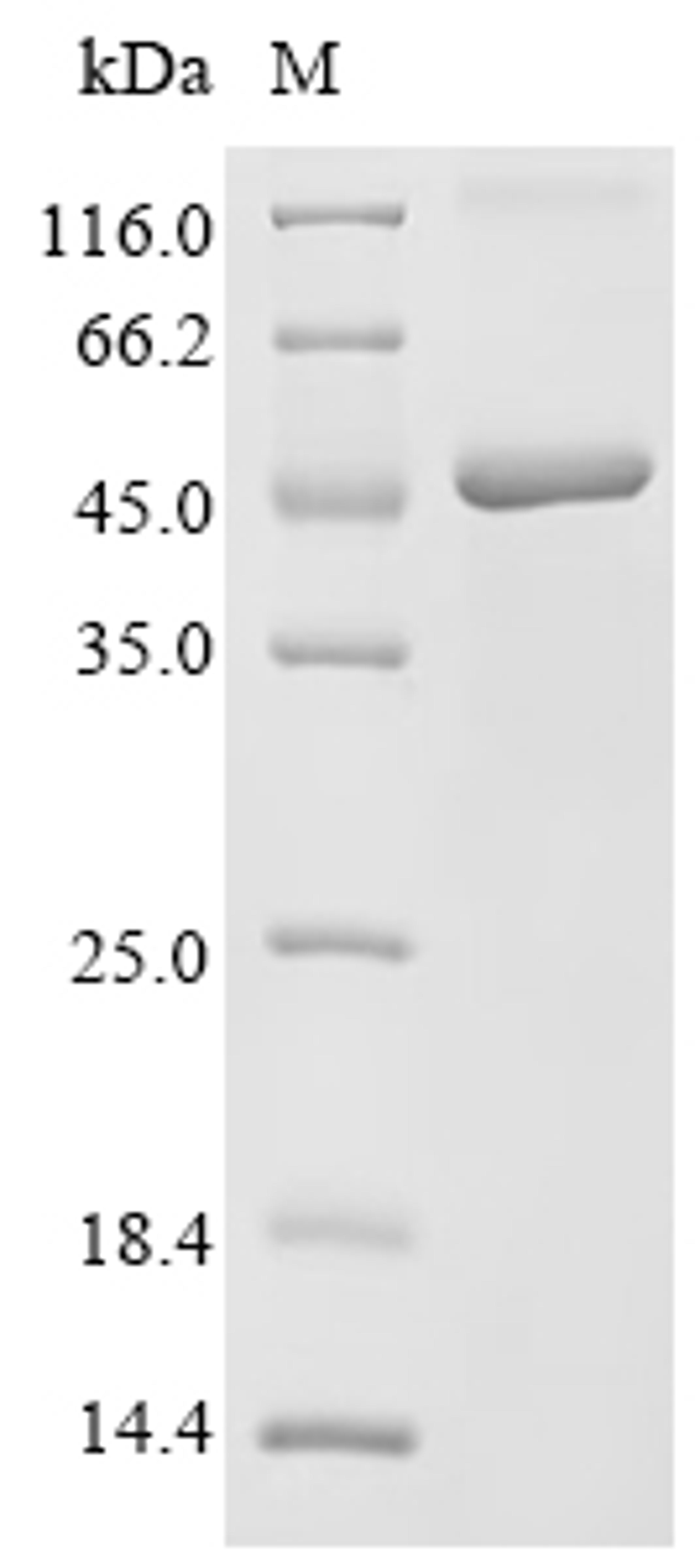 (Tris-Glycine gel) Discontinuous SDS-PAGE (reduced) with 5% enrichment gel and 15% separation gel.