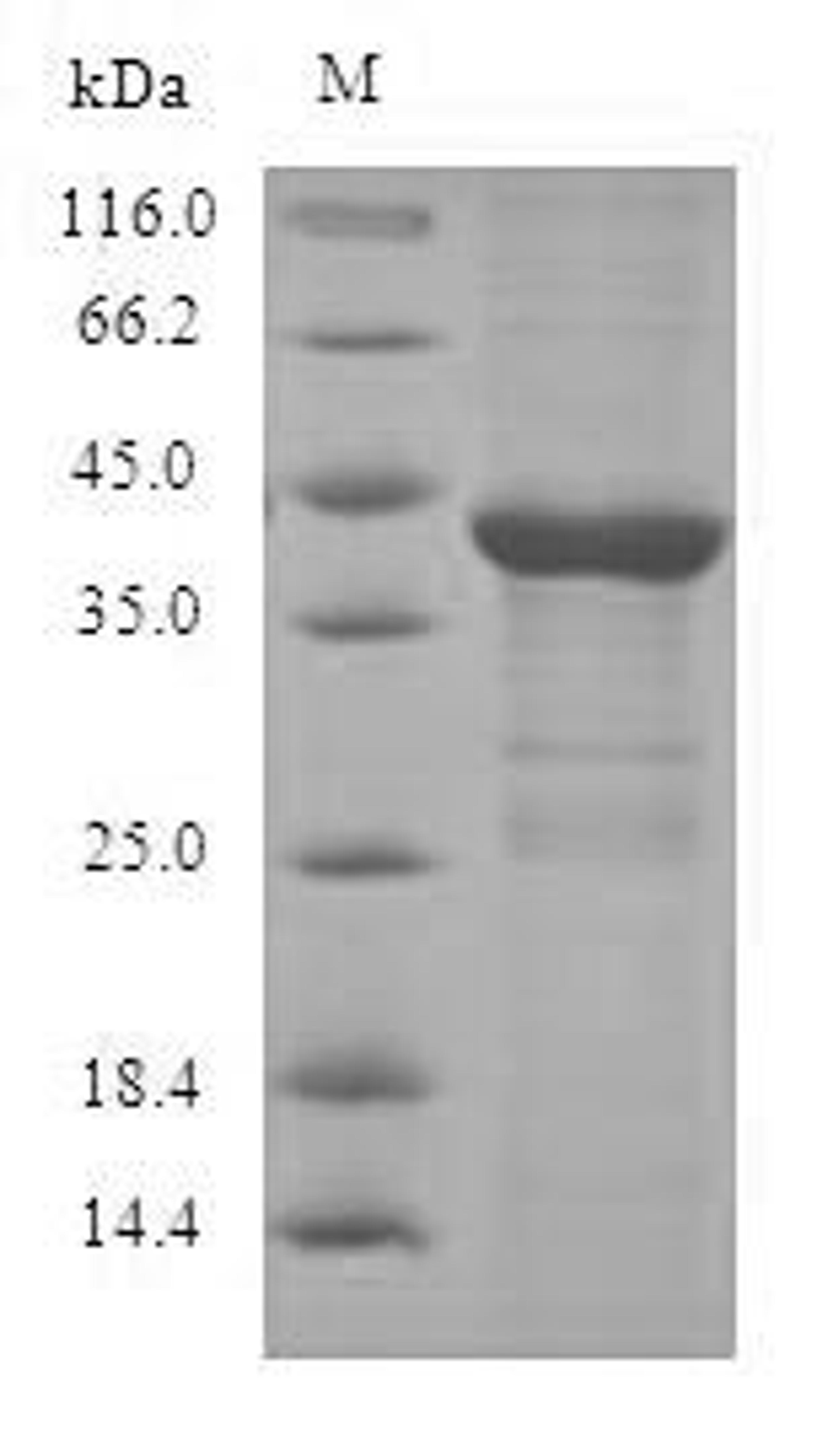 (Tris-Glycine gel) Discontinuous SDS-PAGE (reduced) with 5% enrichment gel and 15% separation gel.