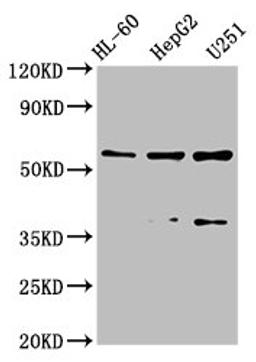 Western Blot. Positive WB detected in: HL-60 whole cell lysate, HepG2 whole cell lysate, U251 whole cell lysate. All lanes: ENTPD1 antibody at 2.6µg/ml. Secondary. Goat polyclonal to rabbit IgG at 1/50000 dilution. Predicted band size: 58, 59, 35, 43, 47, 60 kDa. Observed band size: 58, 43 kDa