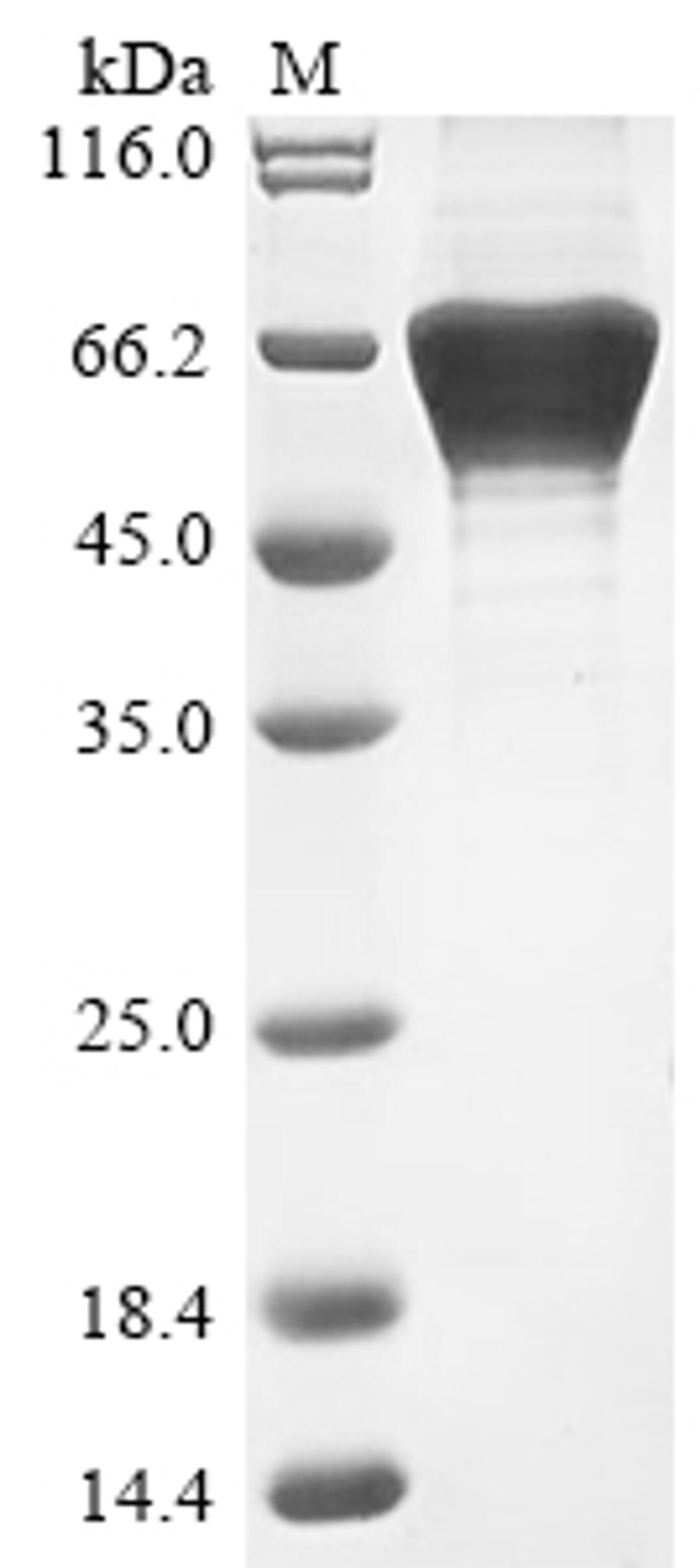 (Tris-Glycine gel) Discontinuous SDS-PAGE (reduced) with 5% enrichment gel and 15% separation gel.