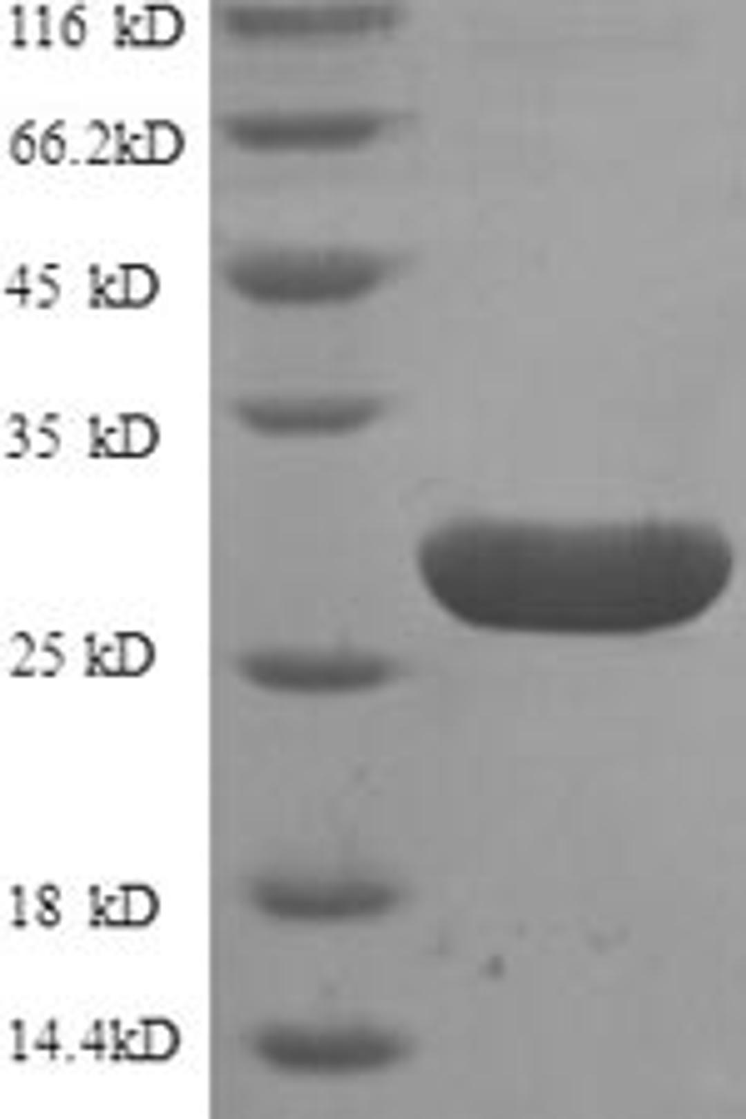 (Tris-Glycine gel) Discontinuous SDS-PAGE (reduced) with 5% enrichment gel and 15% separation gel.