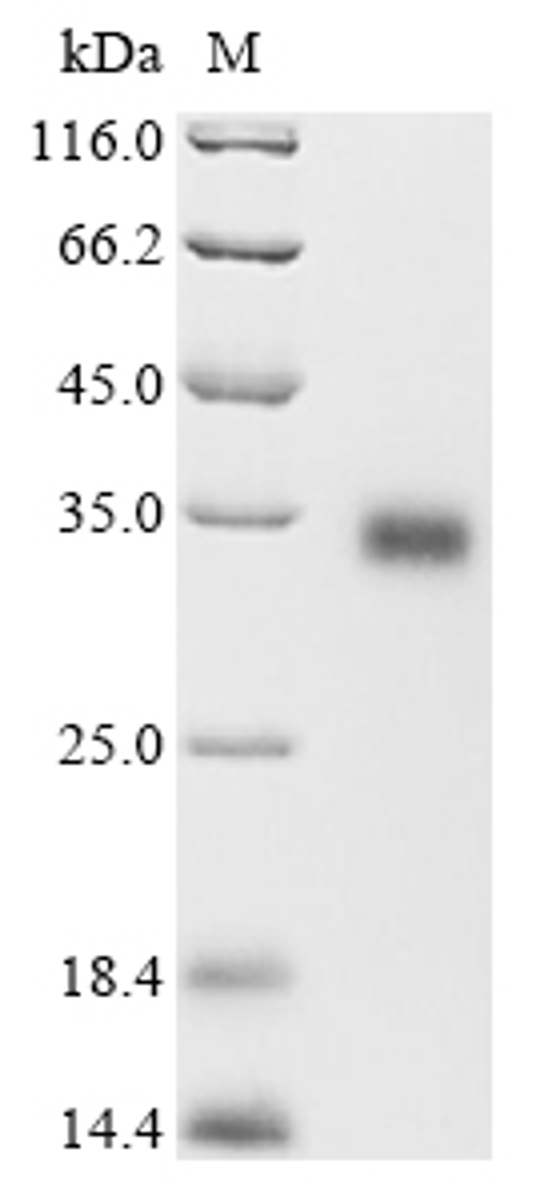 (Tris-Glycine gel) Discontinuous SDS-PAGE (reduced) with 5% enrichment gel and 15% separation gel.