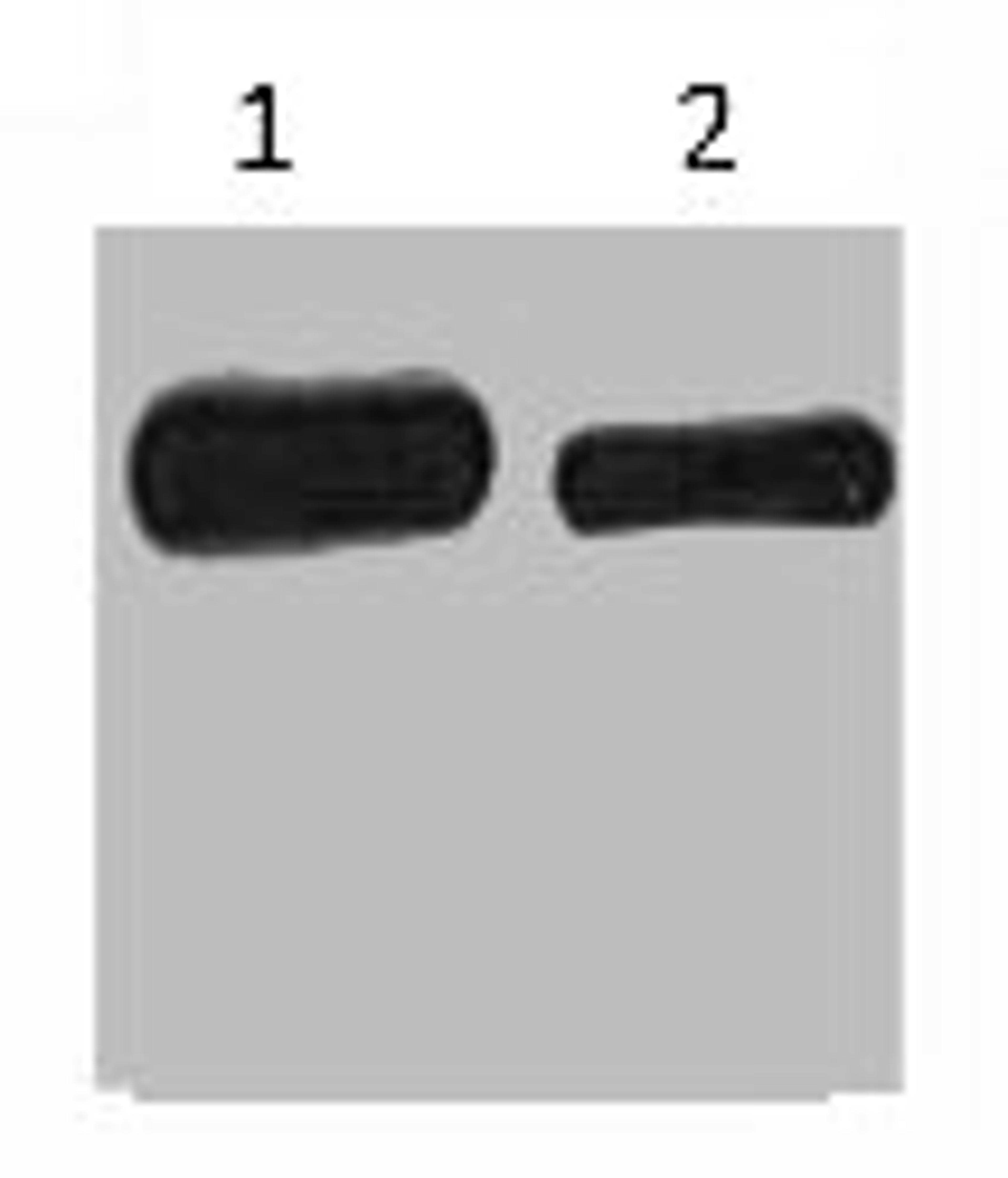 Western blot analysis of His-MBP-C-Myc recombinant protein, diluted at 1) 1:5000  2) 1:10000