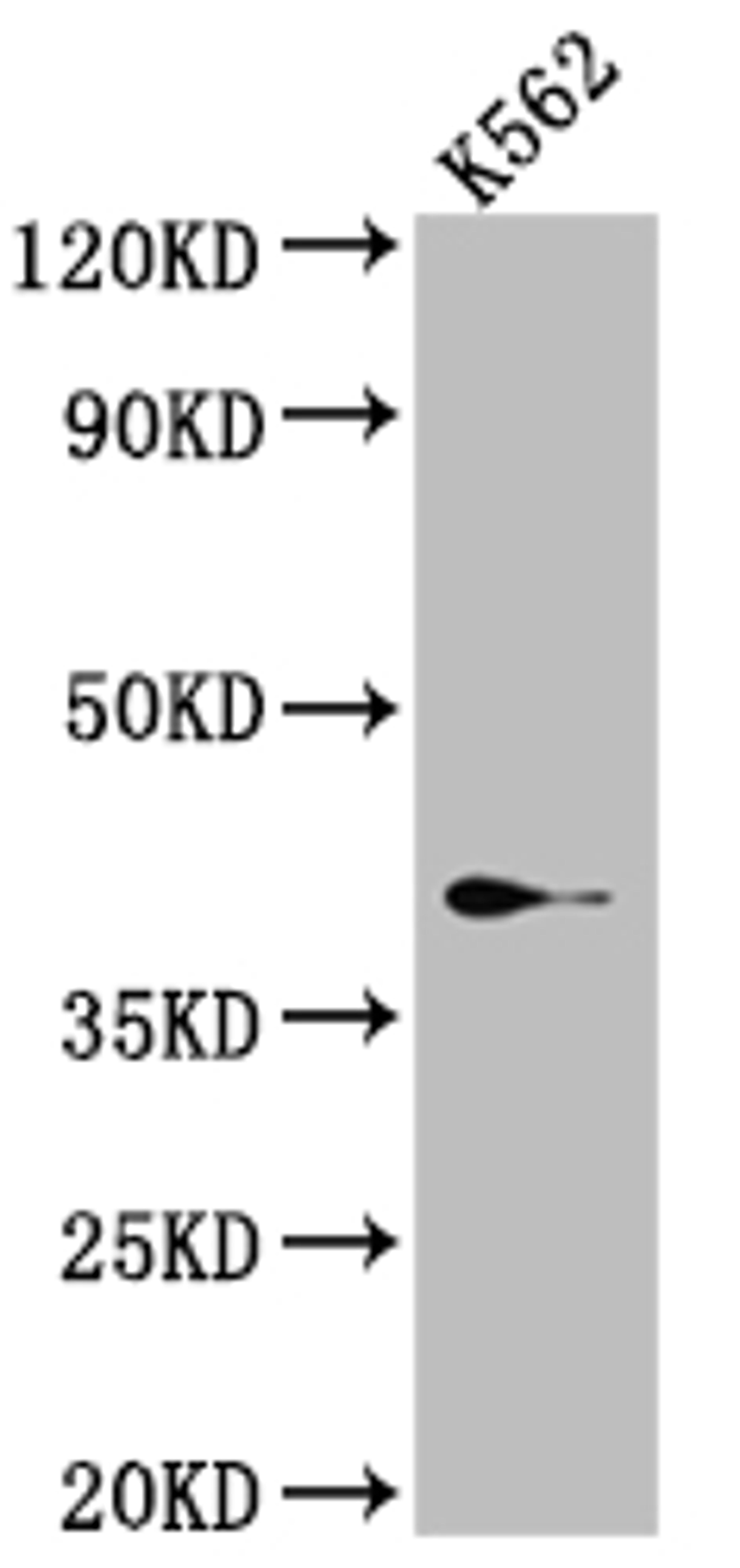 Western Blot. Positive WB detected in: K562 whole cell lysate. All lanes: SAE1 Antibody at 1:1000. Secondary. Goat polyclonal to rabbit IgG at 1/50000 dilution. Predicted band size: 39, 30, 34 kDa. Observed band size: 39 kDa. 