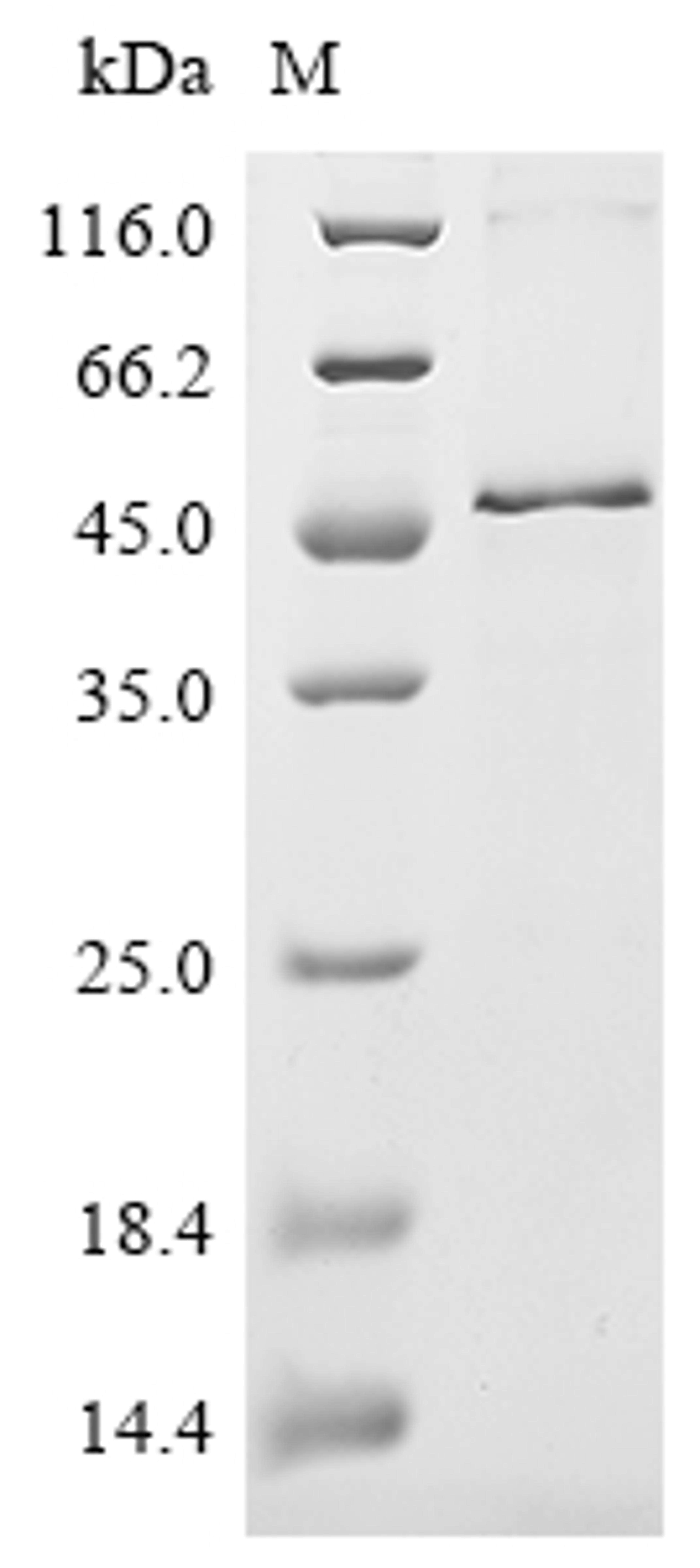 (Tris-Glycine gel) Discontinuous SDS-PAGE (reduced) with 5% enrichment gel and 15% separation gel.