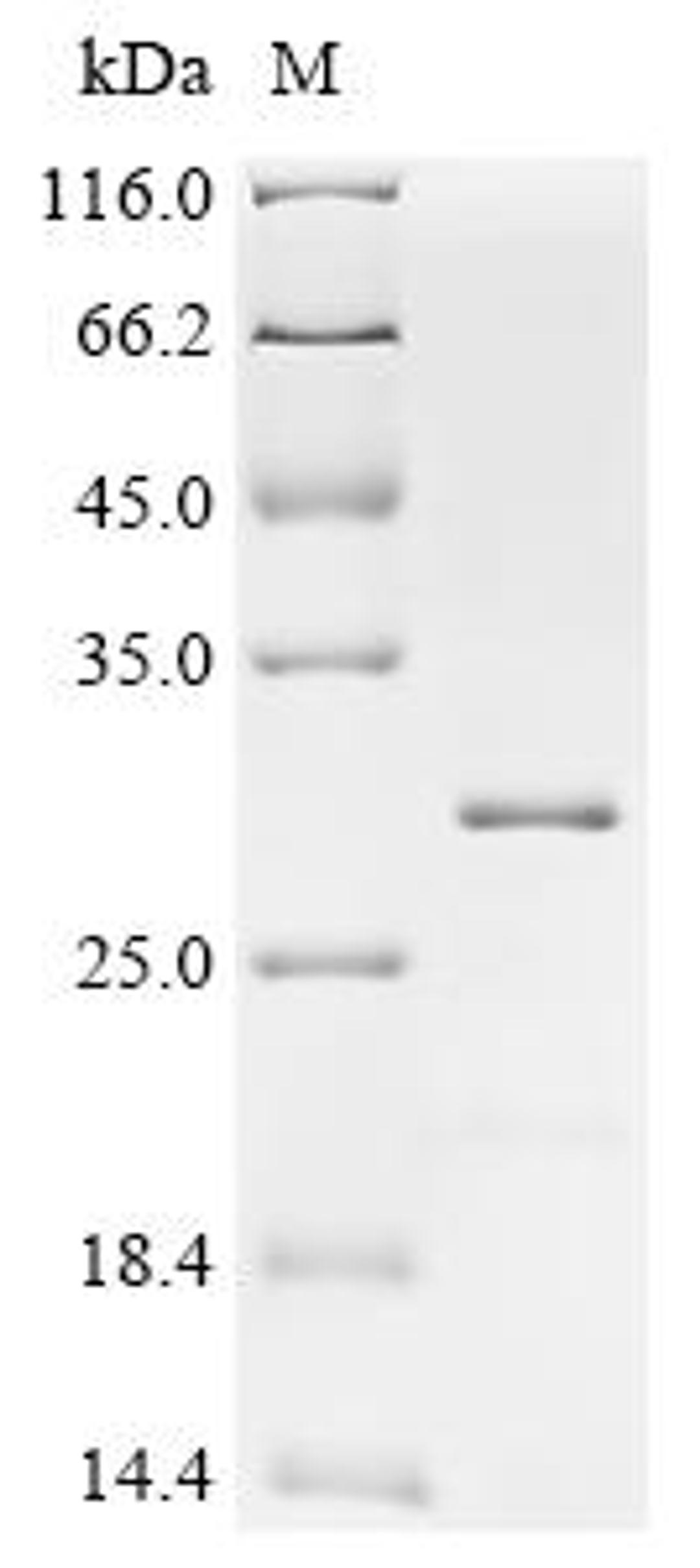 (Tris-Glycine gel) Discontinuous SDS-PAGE (reduced) with 5% enrichment gel and 15% separation gel.
