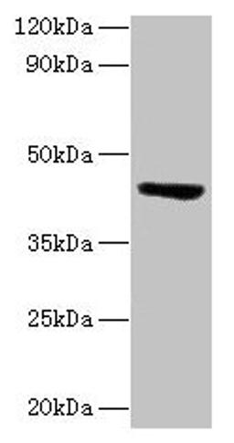 Western blot. All lanes: ST3GAL3 antibody at 2µg/ml + Mouse skeletal muscle tissue. Secondary. Goat polyclonal to rabbit lgG at 1/15000 dilution. Predicted band size: 43, 44, 20, 50, 39, 22, 32, 13, 21, 14, 18, 49, 17, 41, 31, 16, 47, 26, 27, 12, 23, 6, 9 kDa. Observed band size: 43 kDa