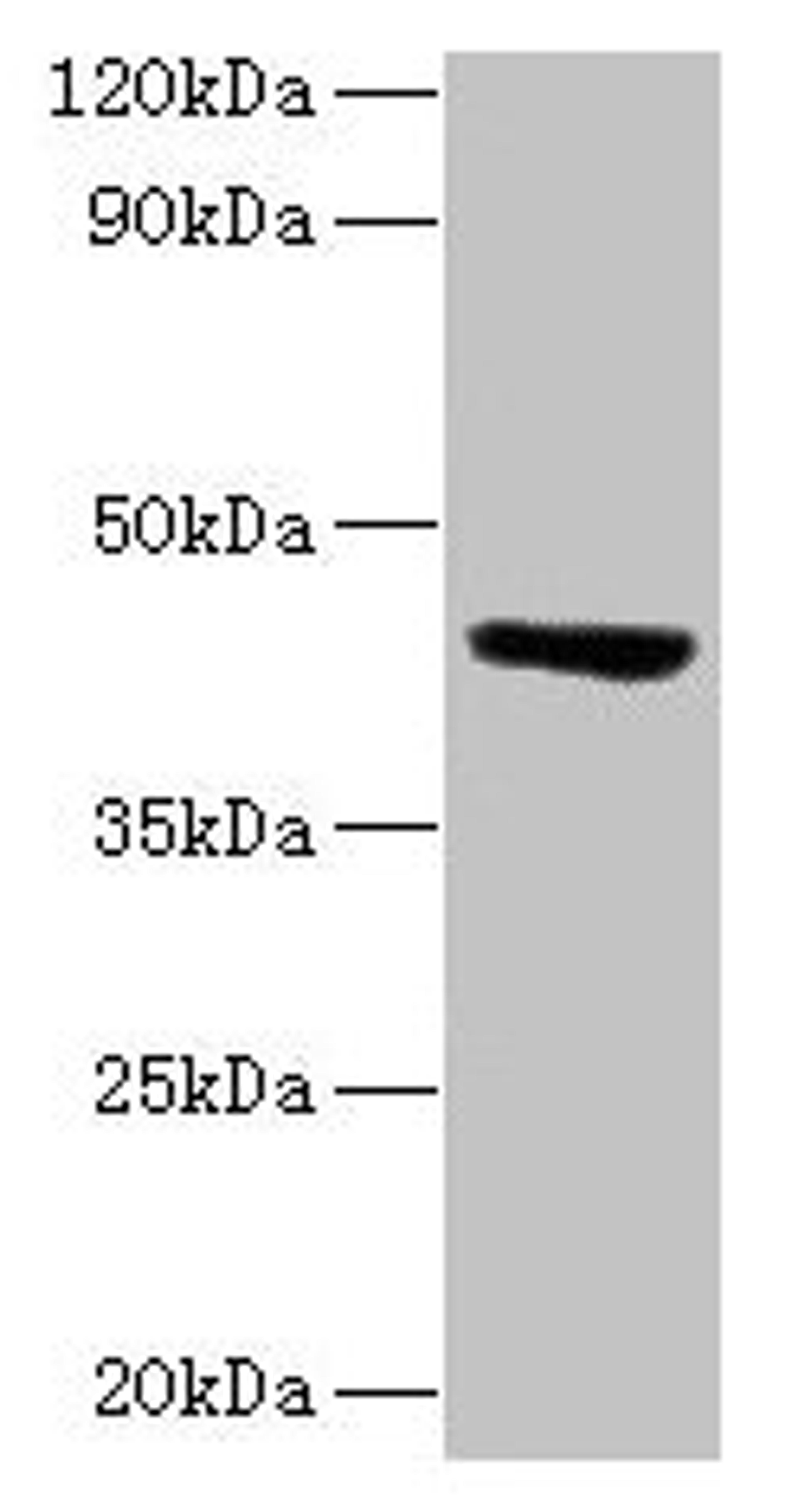Western blot. All lanes: ST3GAL3 antibody at 2µg/ml + Mouse skeletal muscle tissue. Secondary. Goat polyclonal to rabbit lgG at 1/15000 dilution. Predicted band size: 43, 44, 20, 50, 39, 22, 32, 13, 21, 14, 18, 49, 17, 41, 31, 16, 47, 26, 27, 12, 23, 6, 9 kDa. Observed band size: 43 kDa